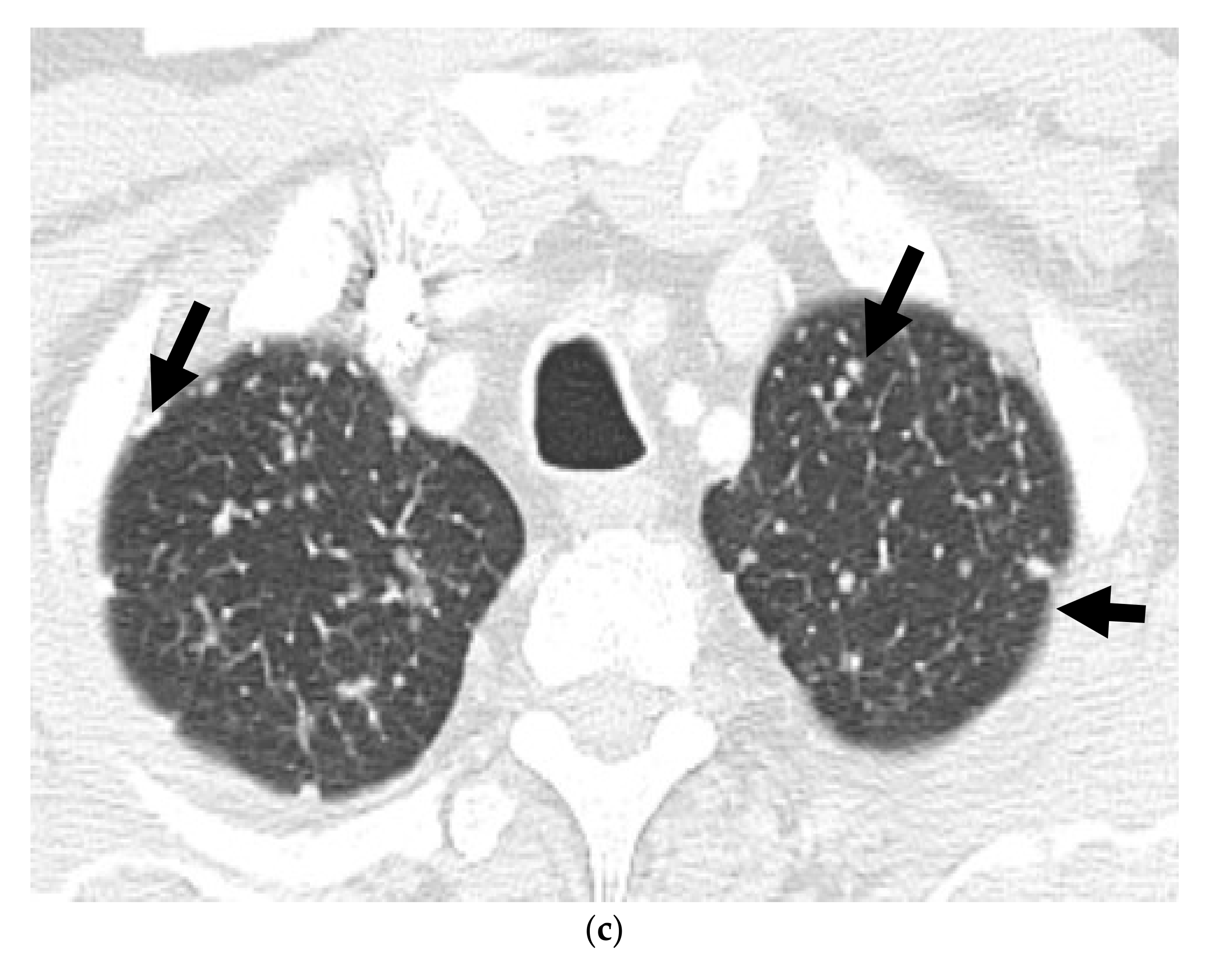 Cancers 13 05765 g002b Cancers 13 05765 g002b