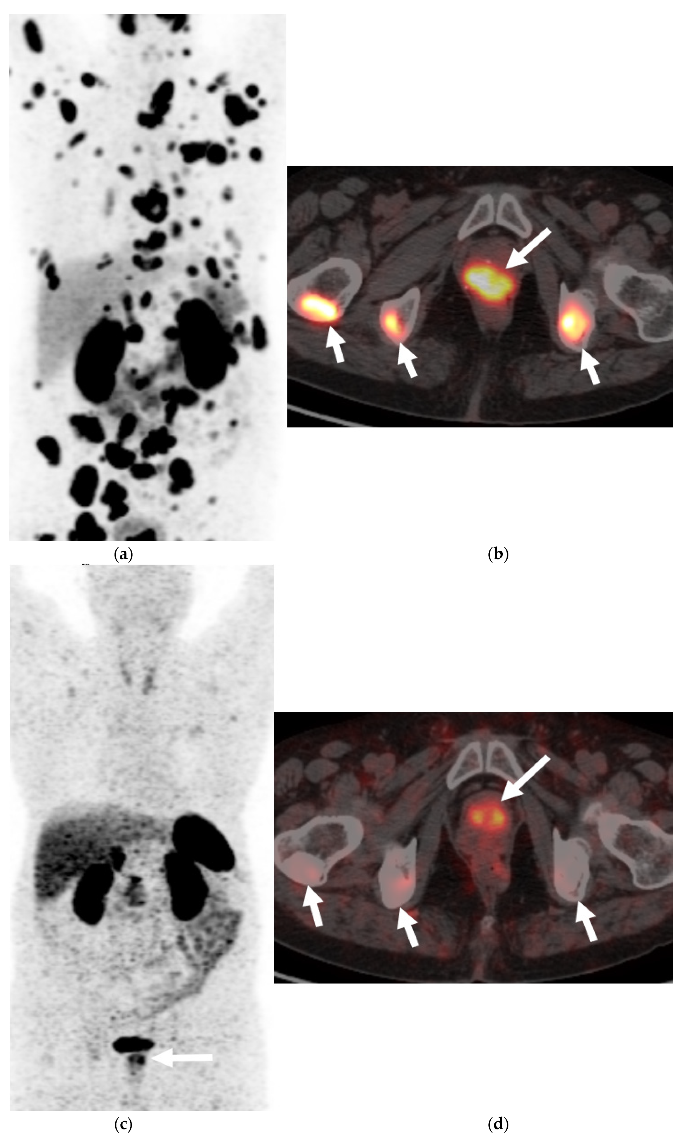 Cancers 13 05765 g005 Cancers 13 05765 g005