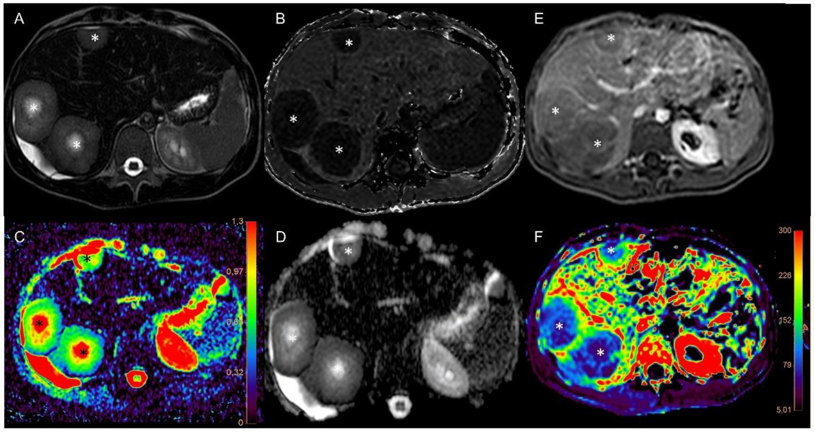 Cancers 13 05880 g002