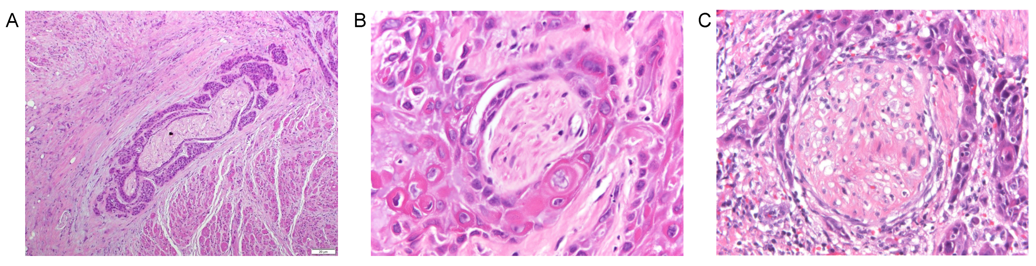 Cancers 13 06011 g003