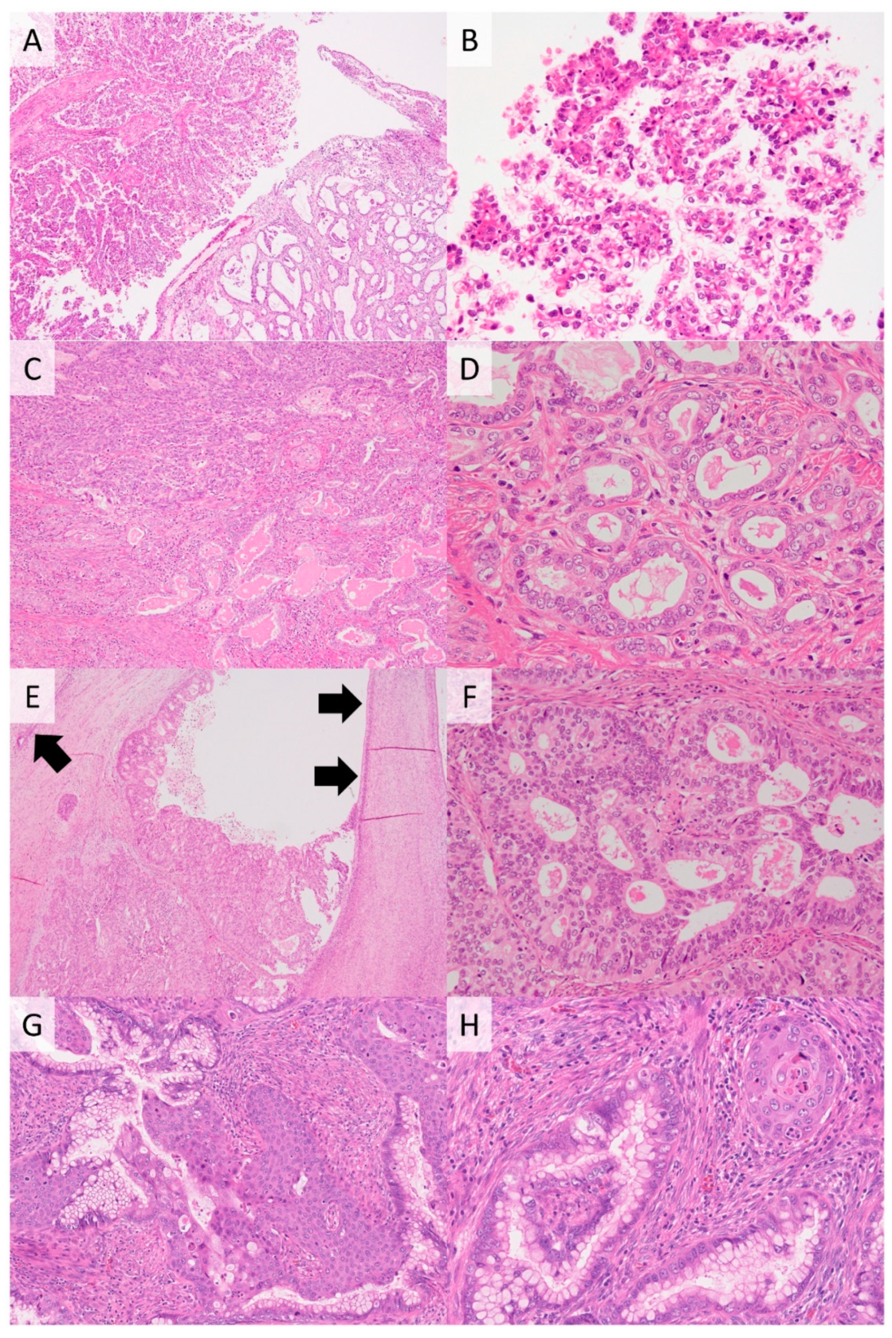 Cancers 13 06351 g004