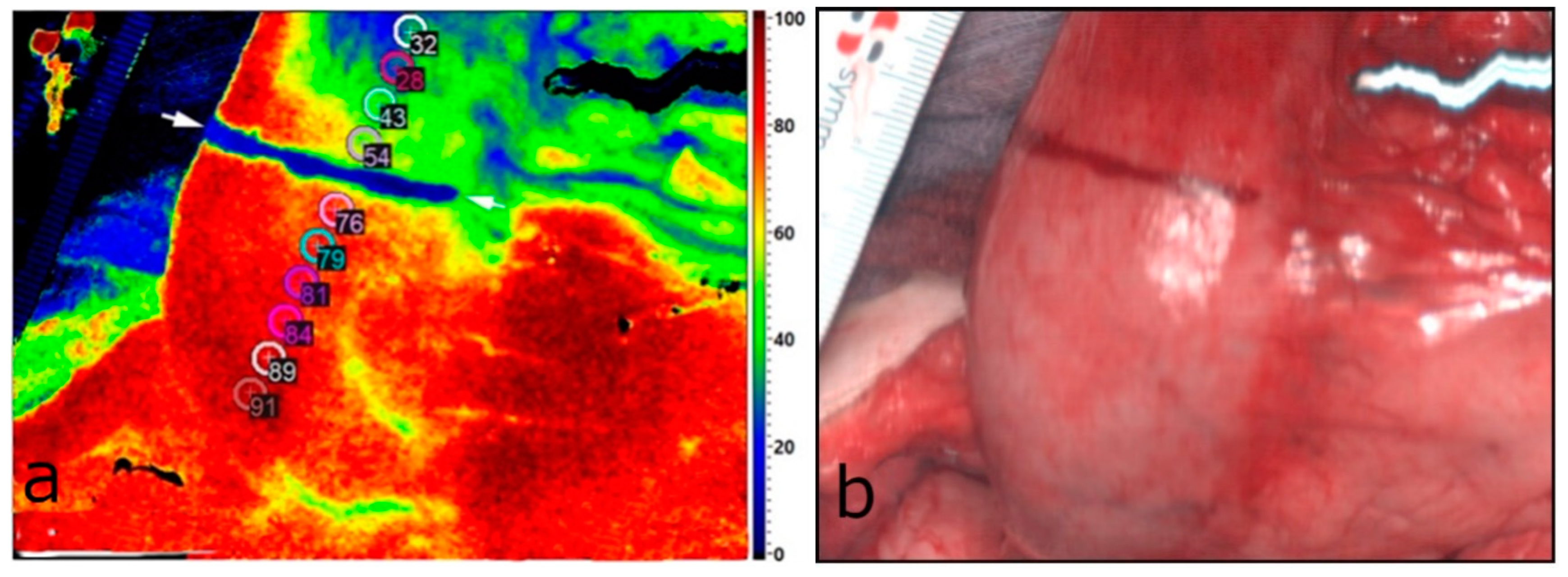 Cancers 14 00097 g001 Cancers 14 00097 g001