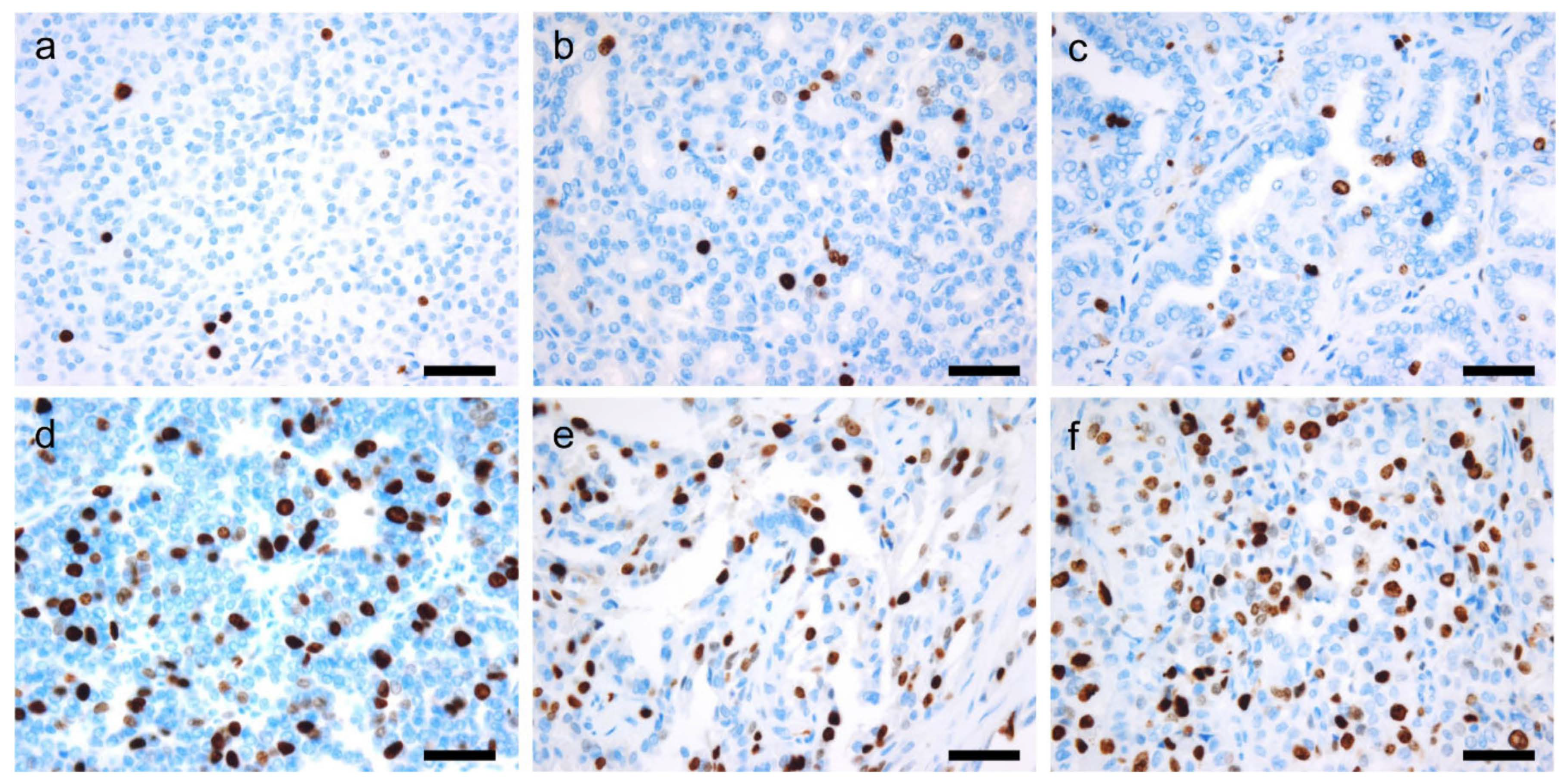 Cancers 14 00204 g004 Cancers 14 00204 g004