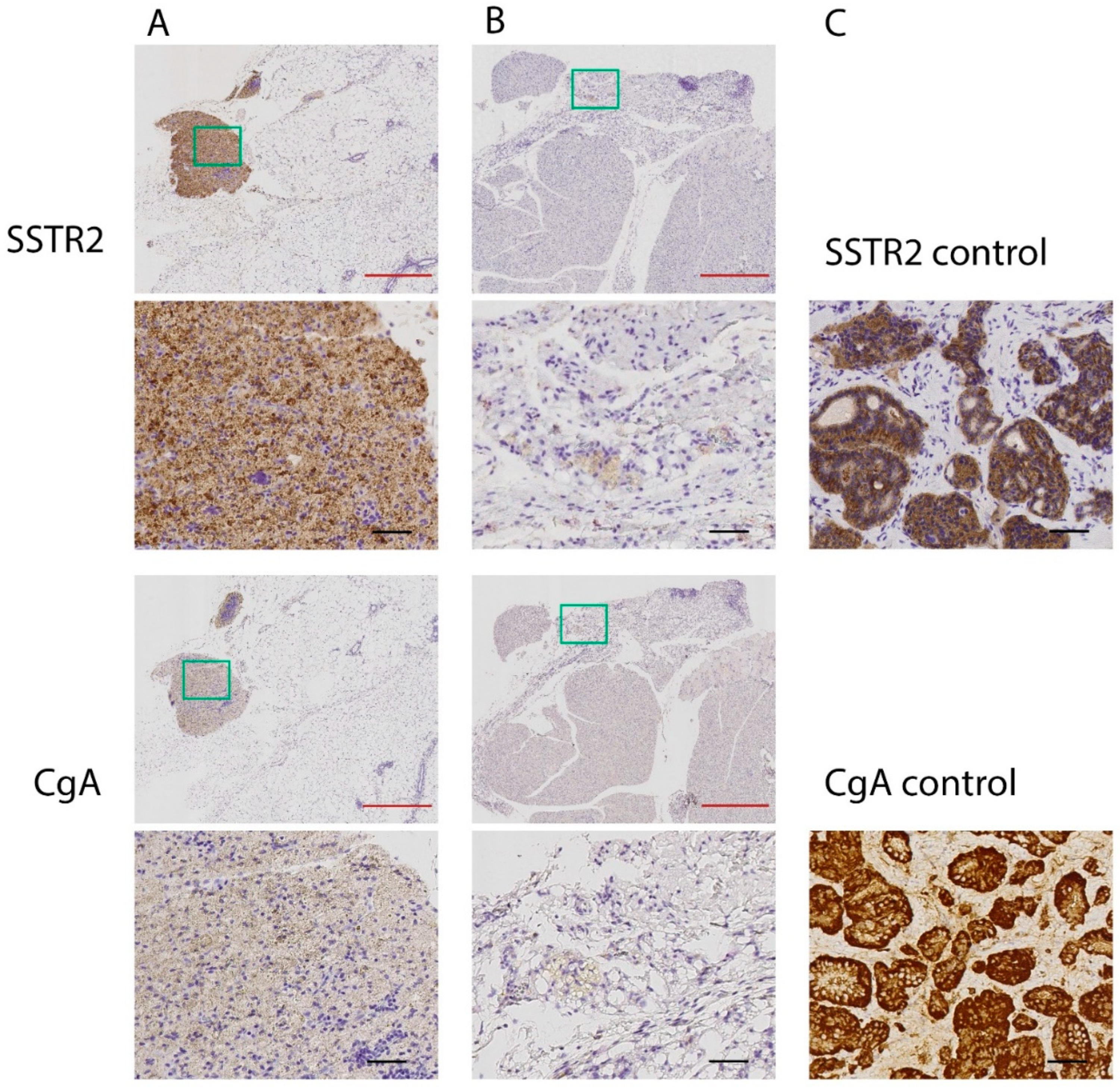 Cancers 14 00235 g002