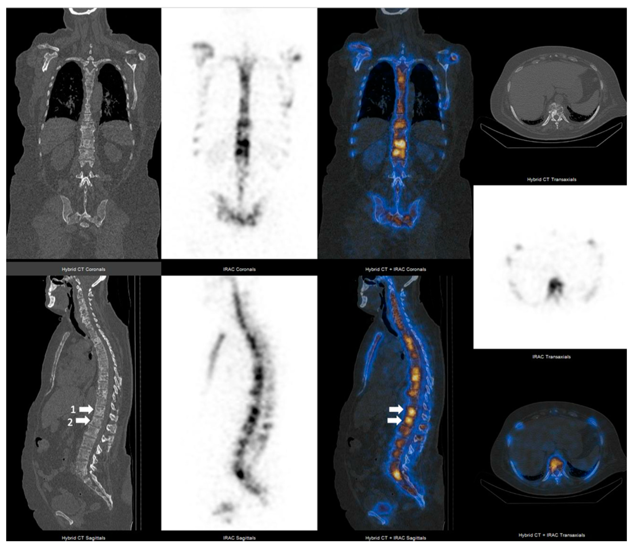 Cancers 14 00273 g002