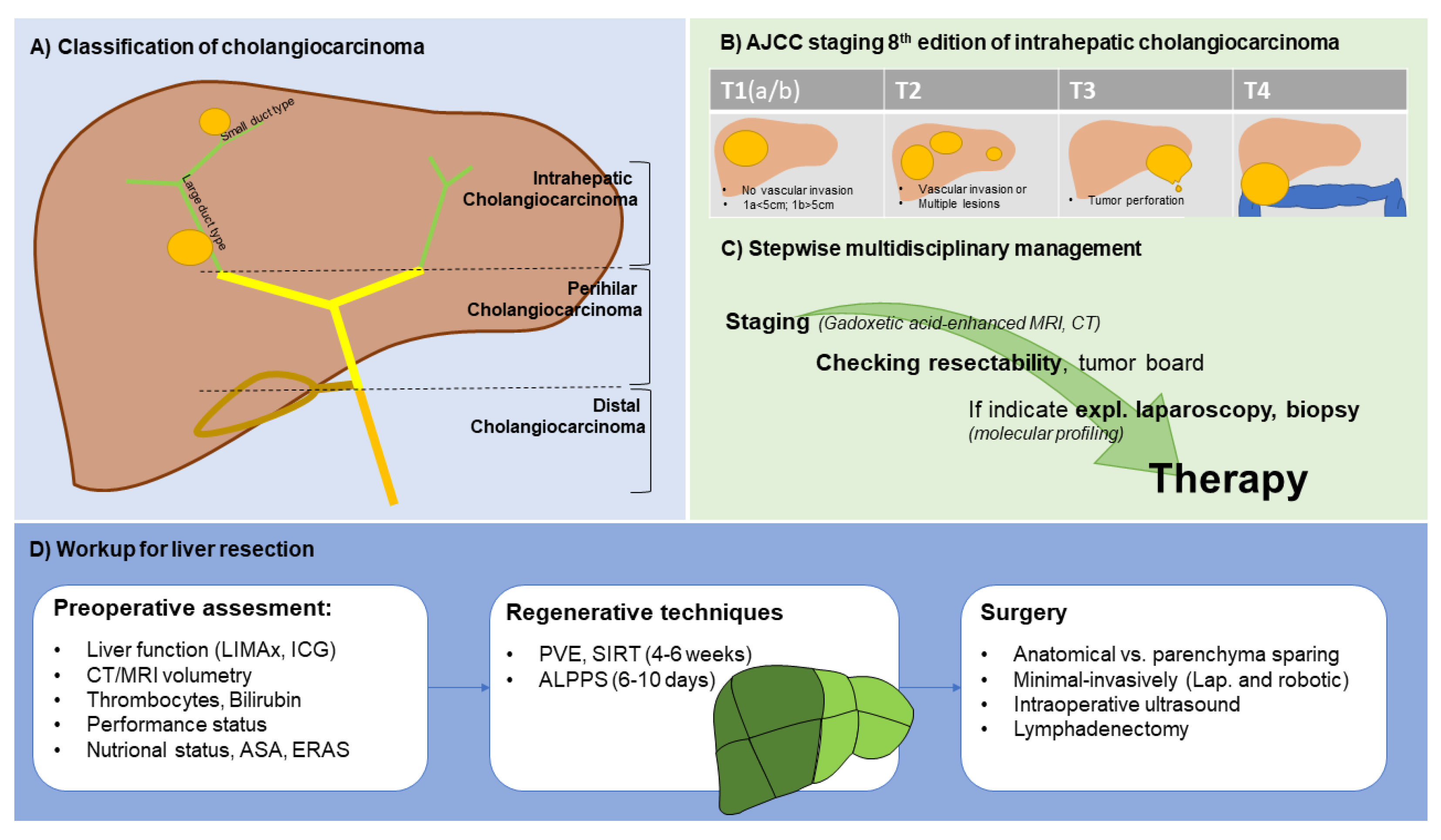 Cancers | Free Full-Text | Treatment of Intrahepatic  Cholangiocarcinoma&mdash;A Multidisciplinary Approach | HTML