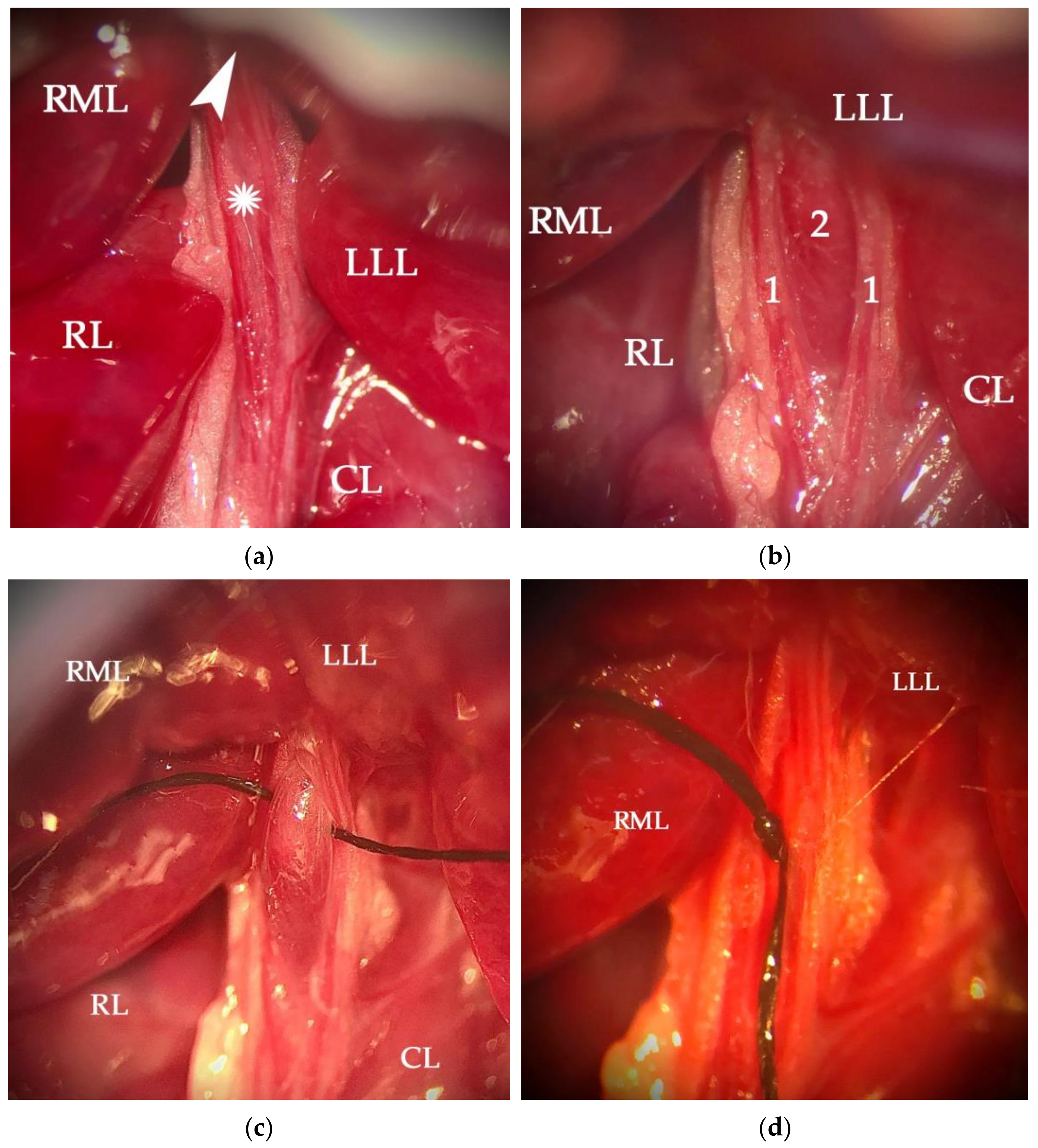 Cancers 14 00371 g002