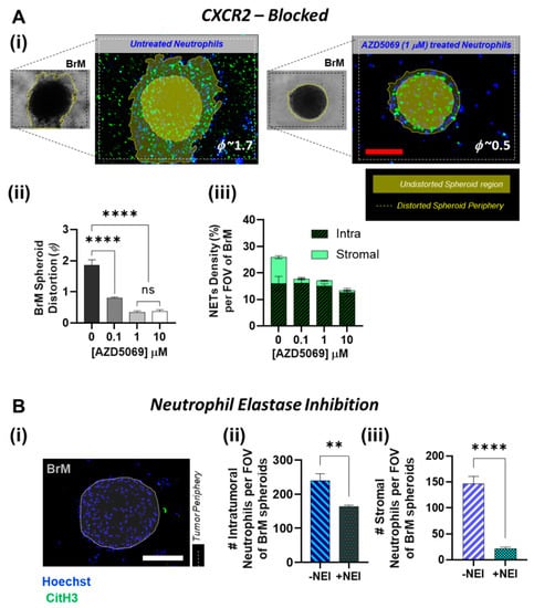 Blocking immunosuppressive neutrophils deters pY696-EZH2–driven brain  metastases