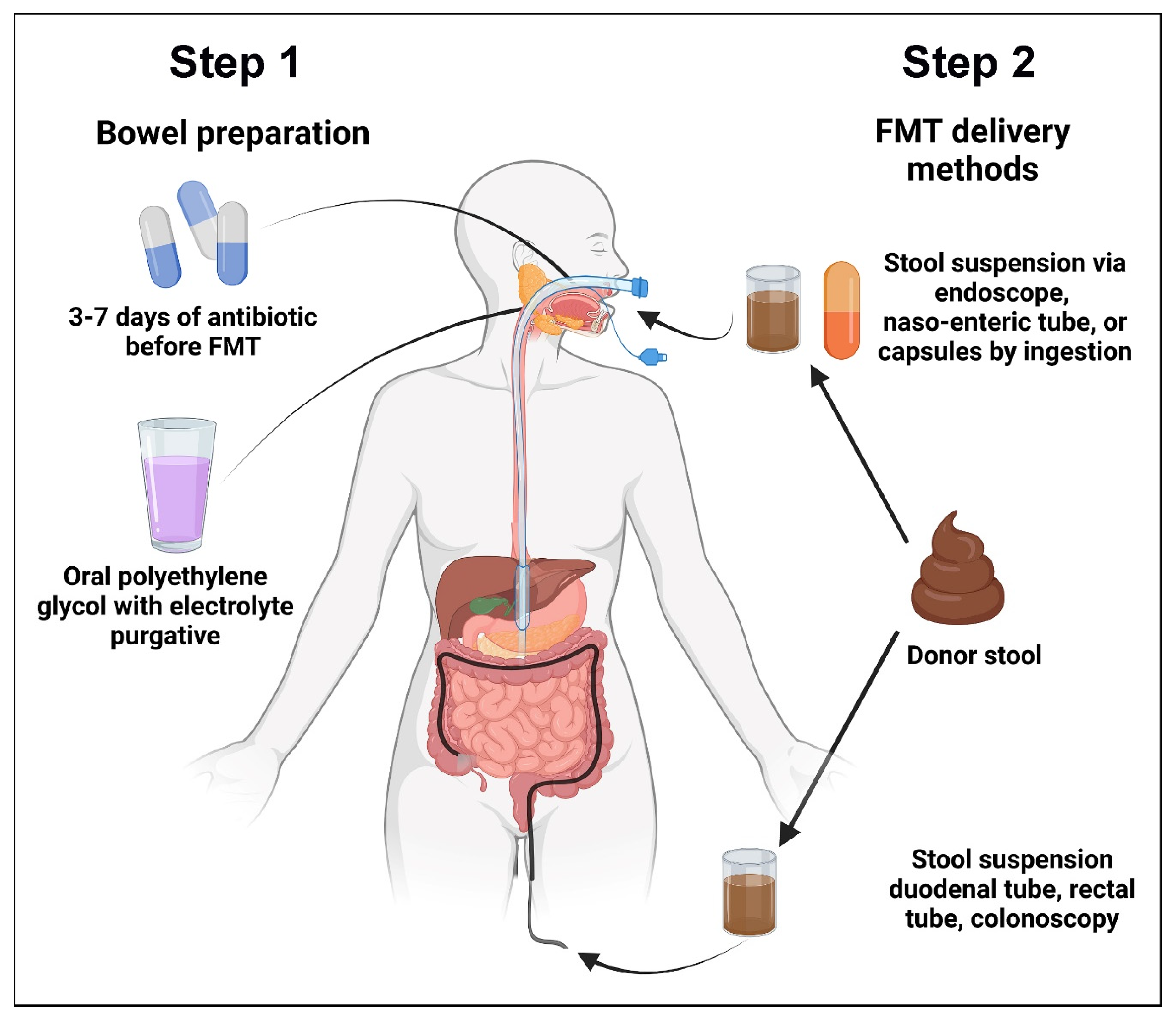 Cancers | Free Full-Text | Fecal Microbiota Transplant for Hematologic and  Oncologic Diseases: Principle and Practice
