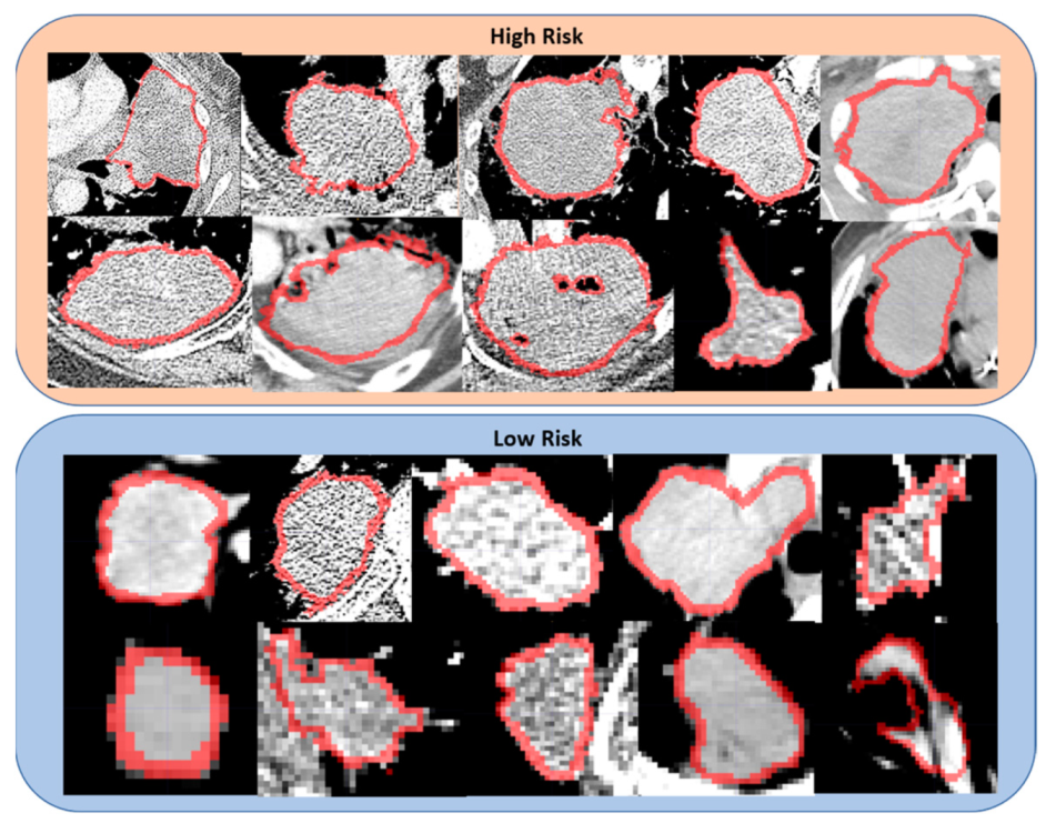 Cancers 14 00700 g004