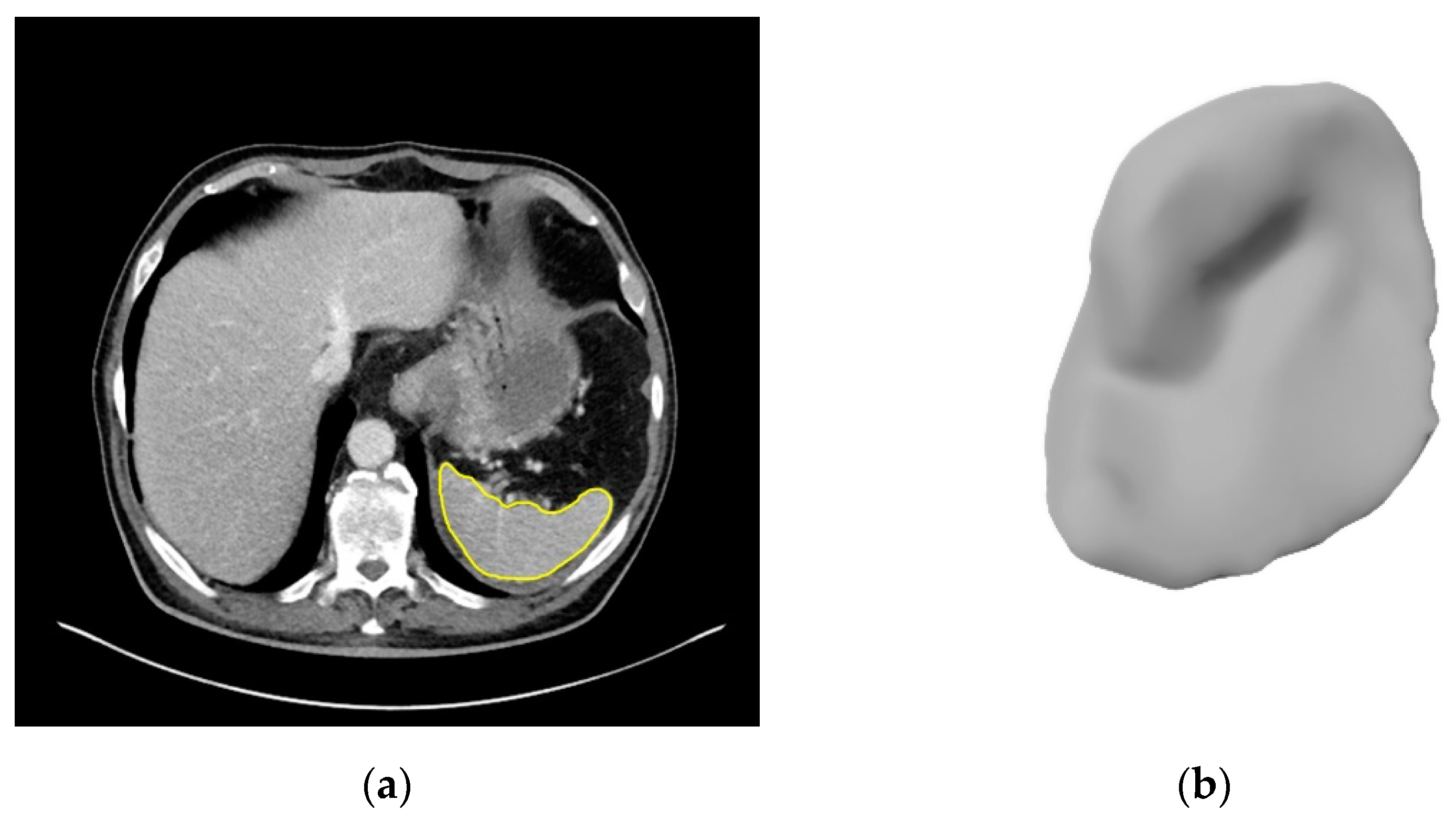 Cancers 14 00713 g003a