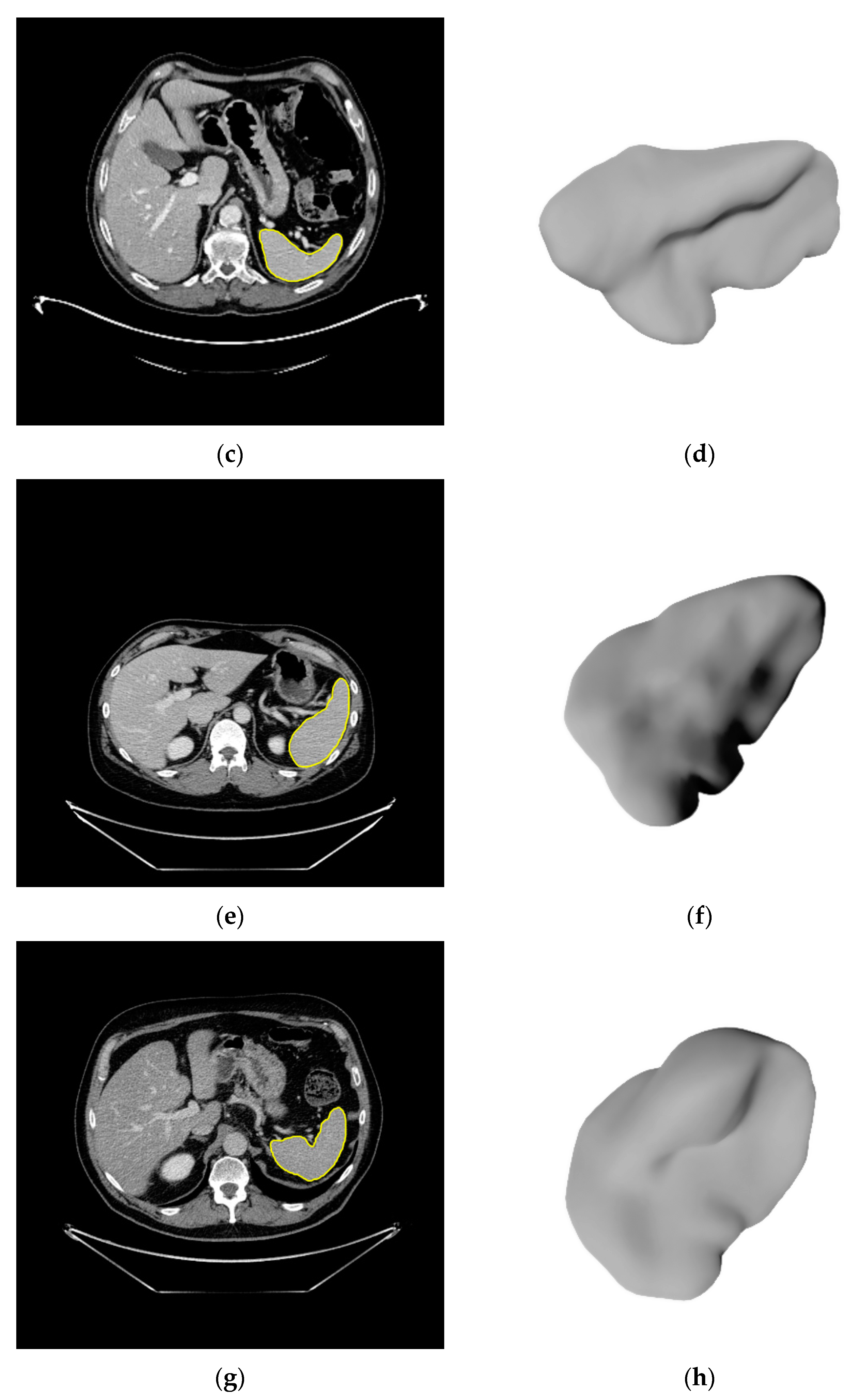 Cancers 14 00713 g003b