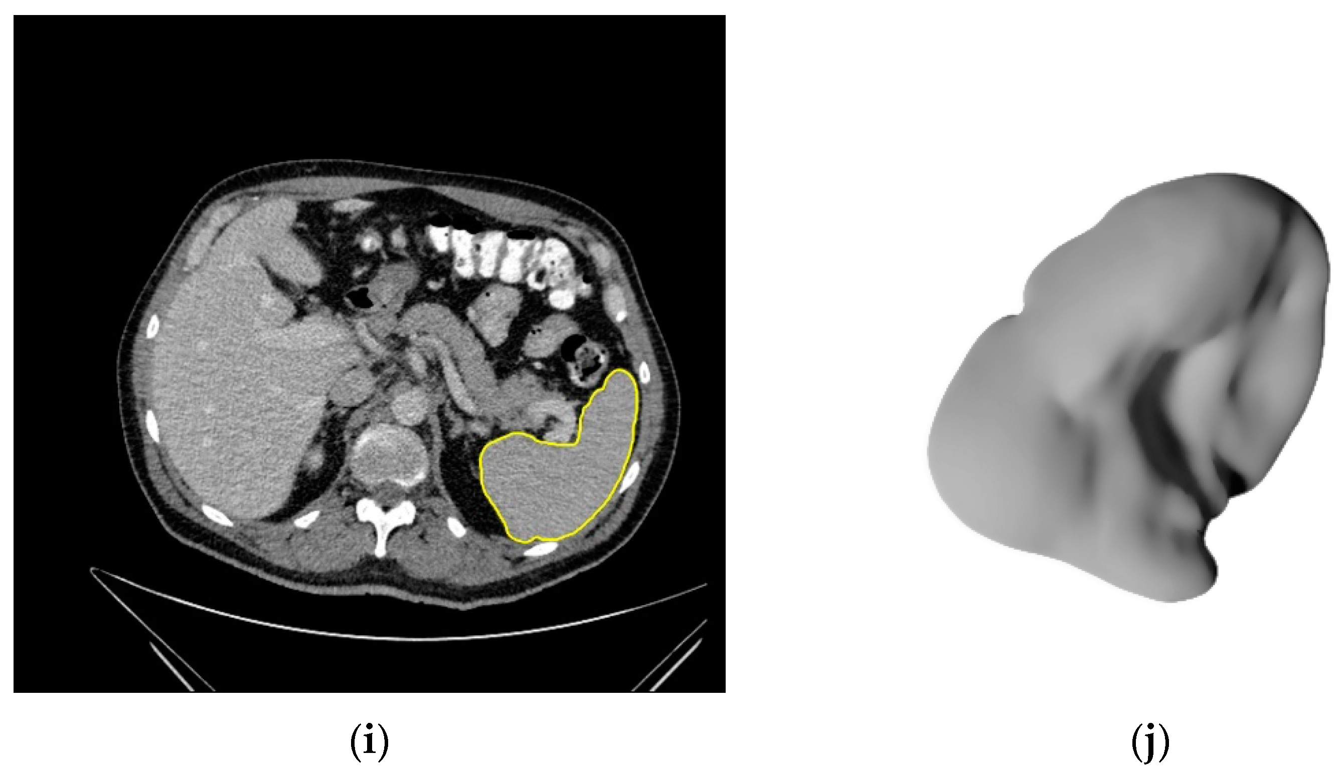 Cancers 14 00713 g003c