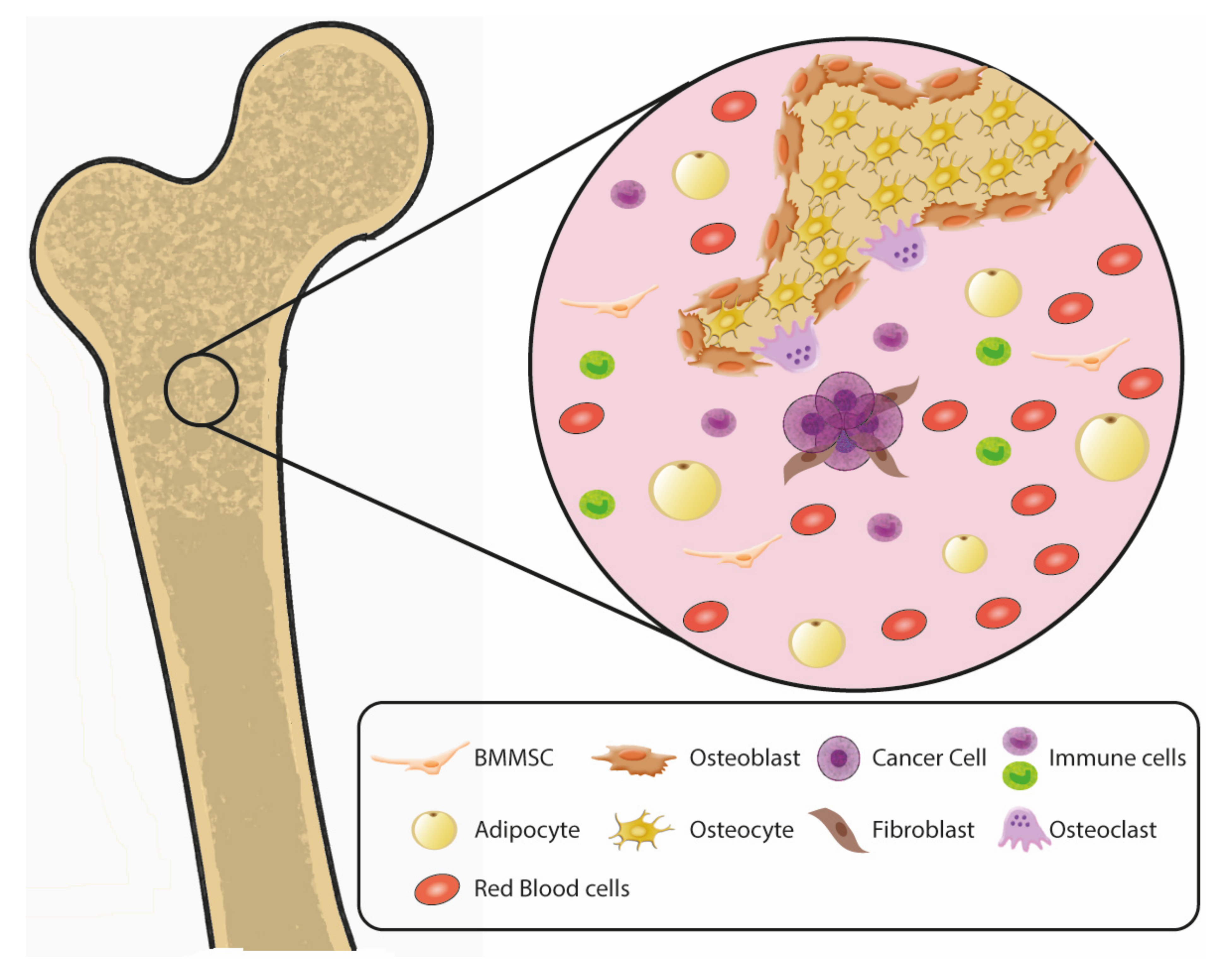 Cancers | Free Full-Text | Advancing Treatment of Bone Metastases through  Novel Translational Approaches Targeting the Bone Microenvironment