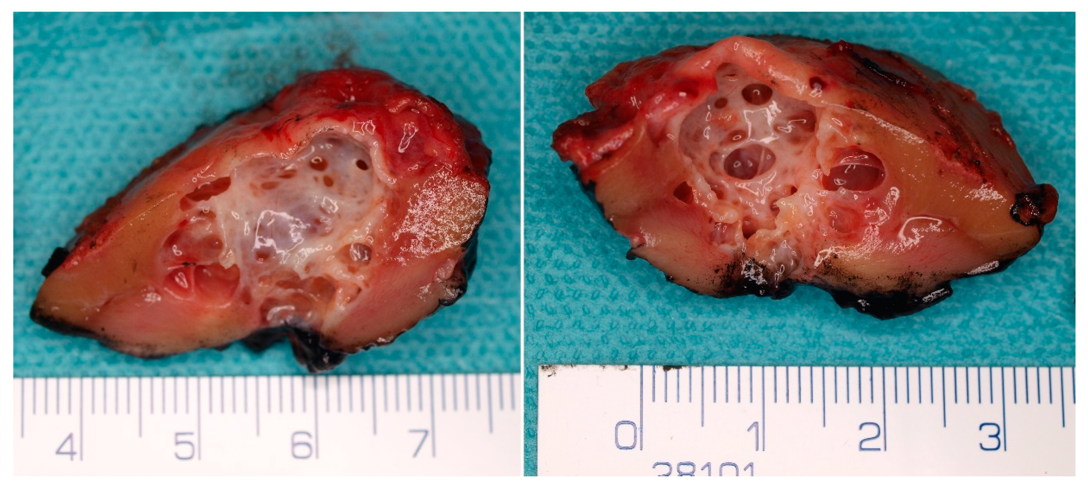 Cancers 14 00831 g002