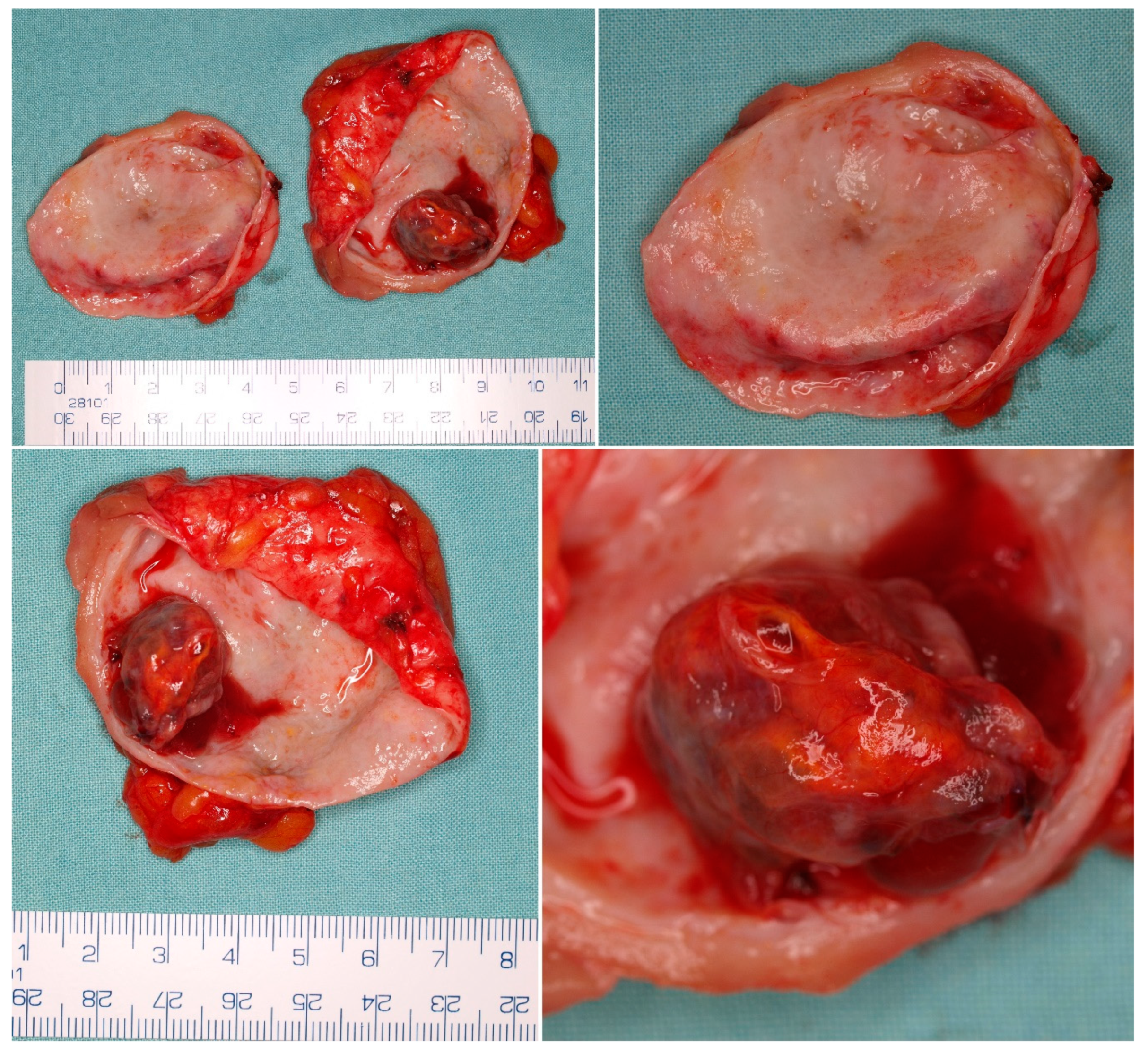 Cancers 14 00831 g003