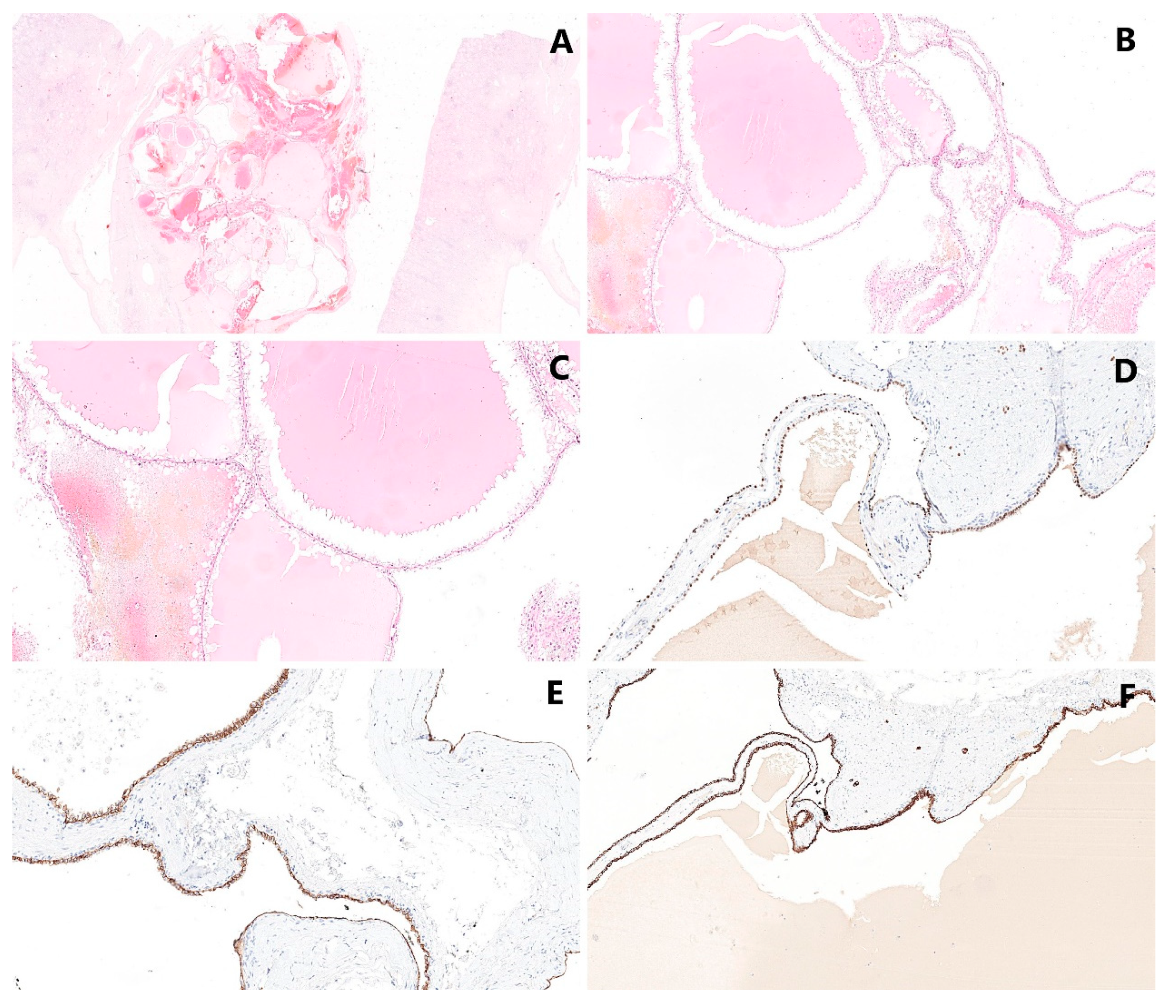 Cancers 14 00831 g004