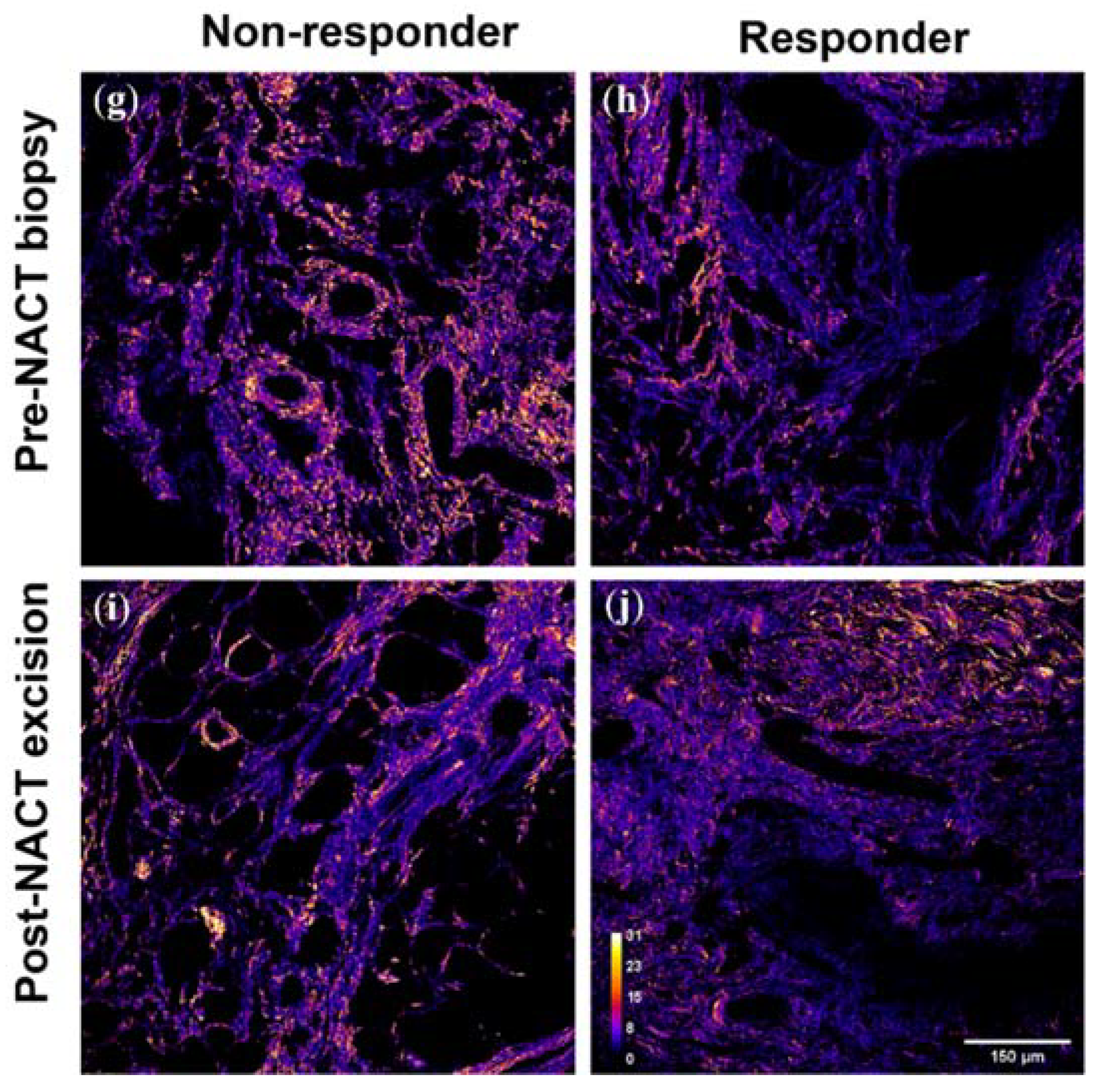 Cancers 14 00857 g001b Cancers 14 00857 g001b