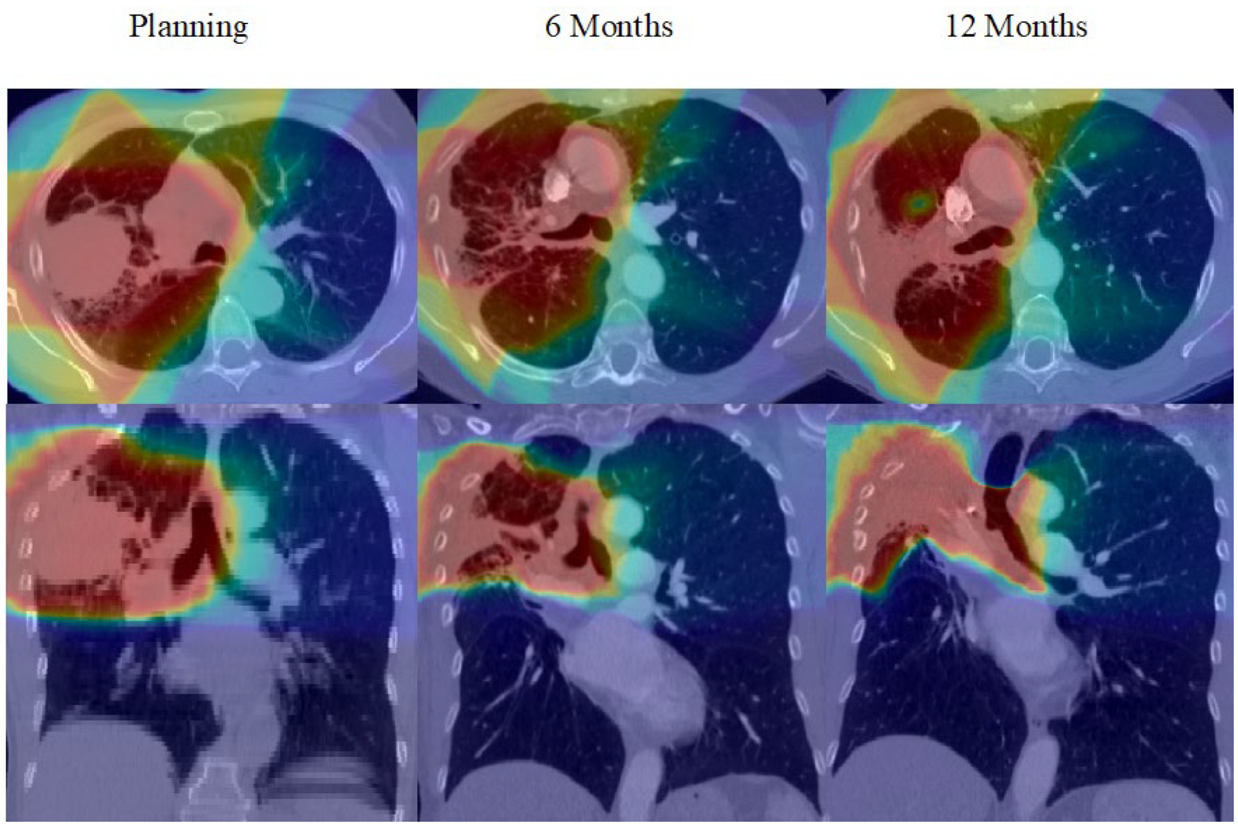 Cancers 14 00946 g002