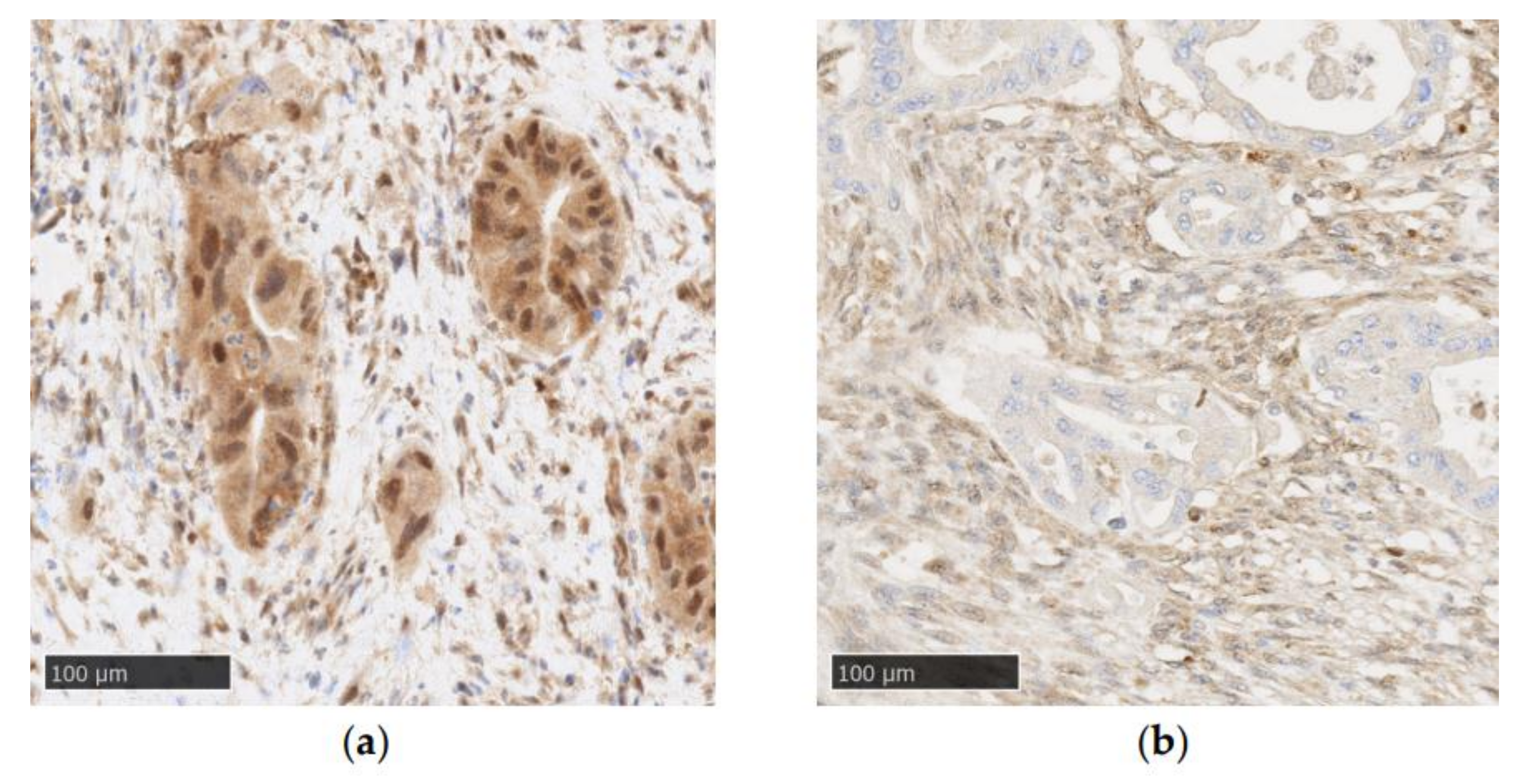 Cancers 14 00973 g002 Cancers 14 00973 g002