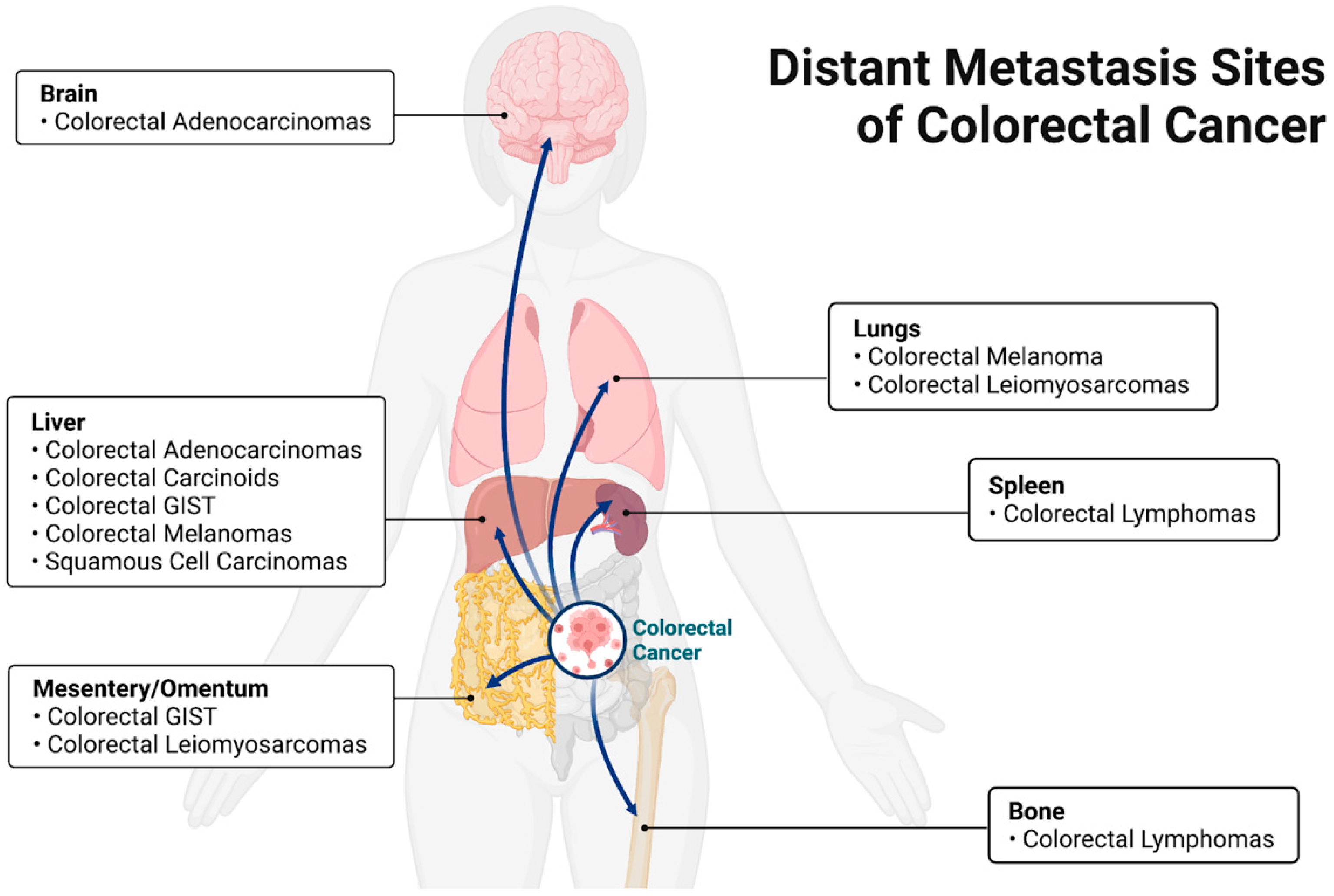 Cancers | Free Full-Text | Bacterial Involvement in Progression and  Metastasis of Colorectal Neoplasia