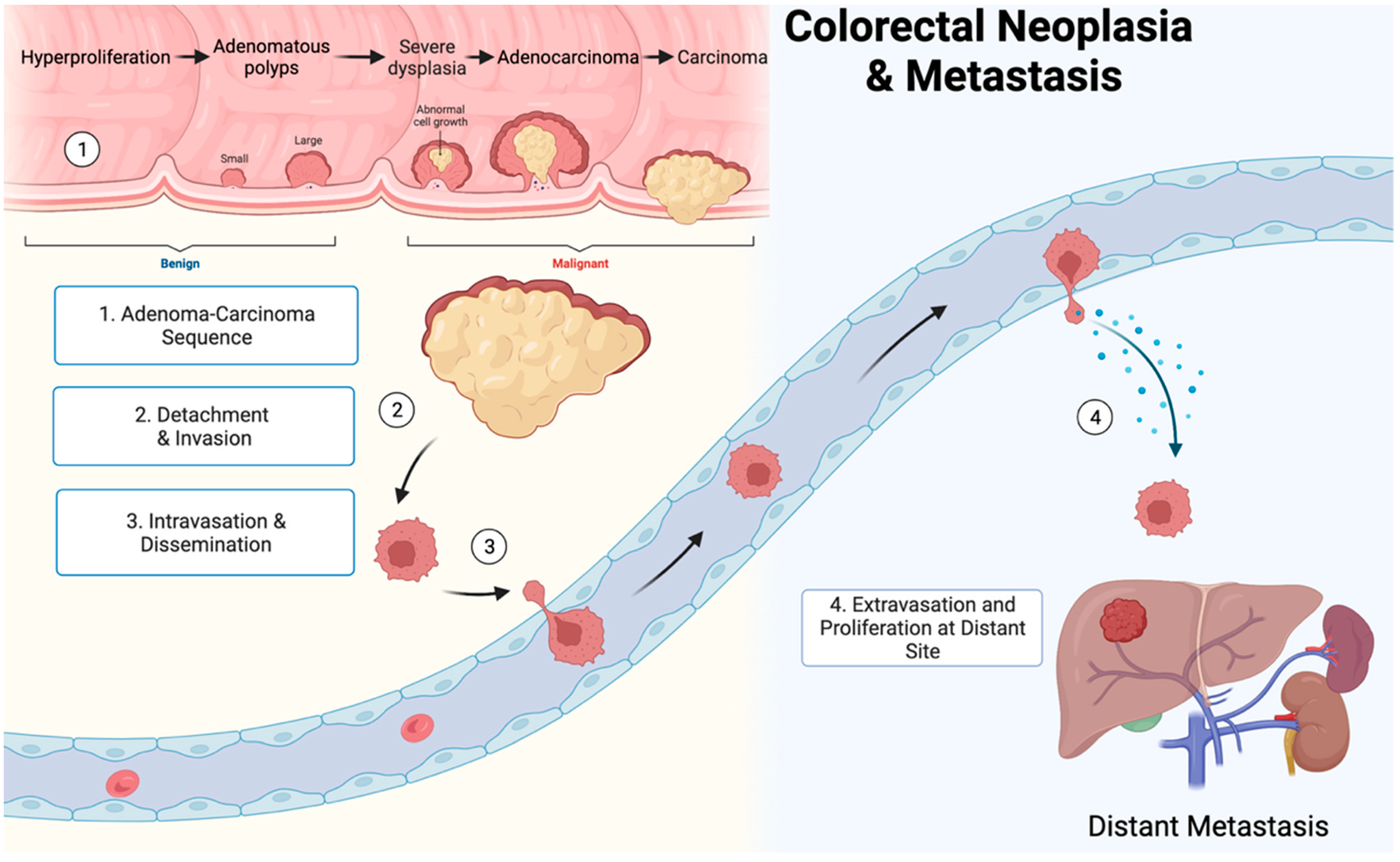 Cancers 14 01019 g003 Cancers 14 01019 g003