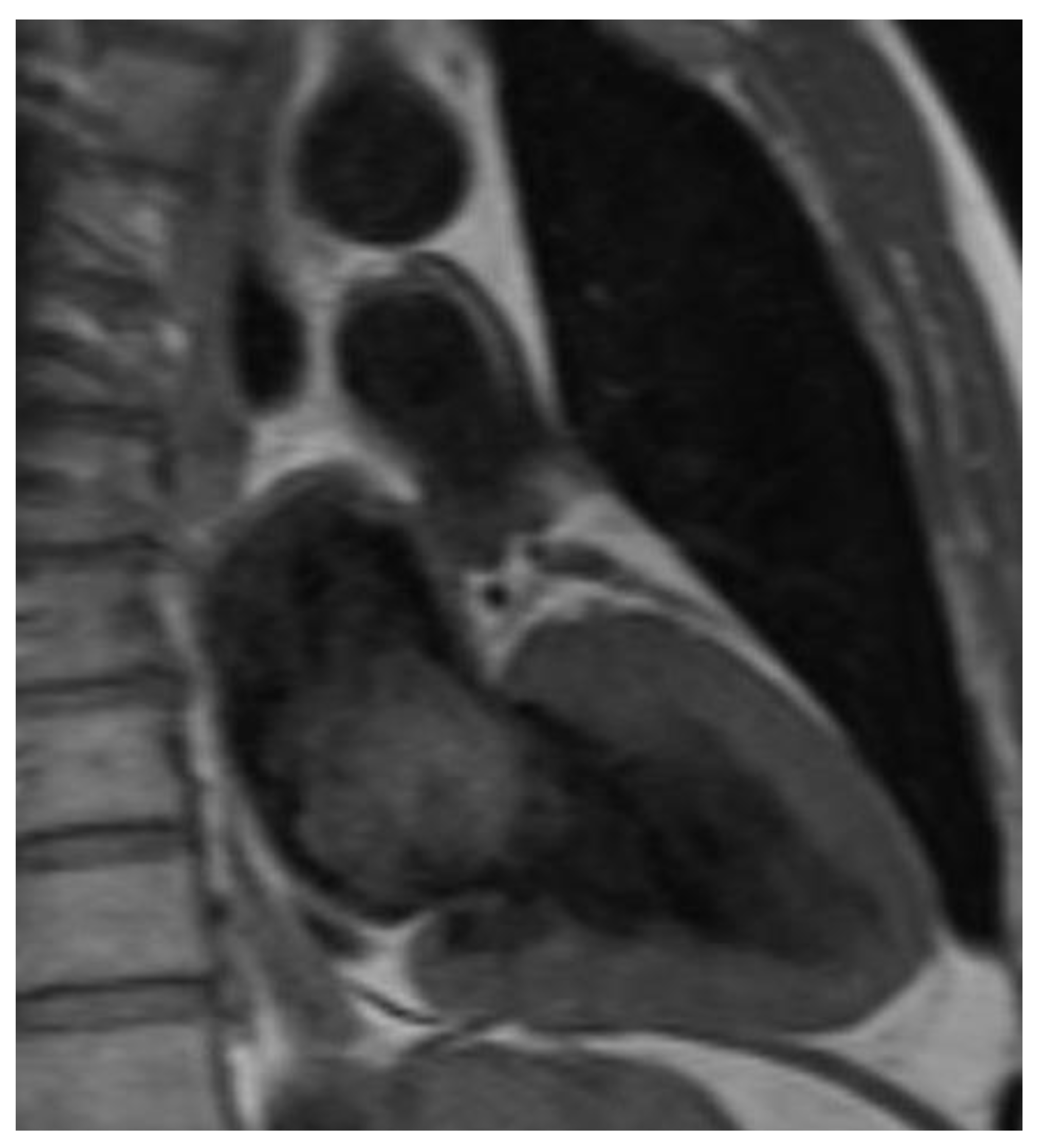 Cancers 14 01111 g003