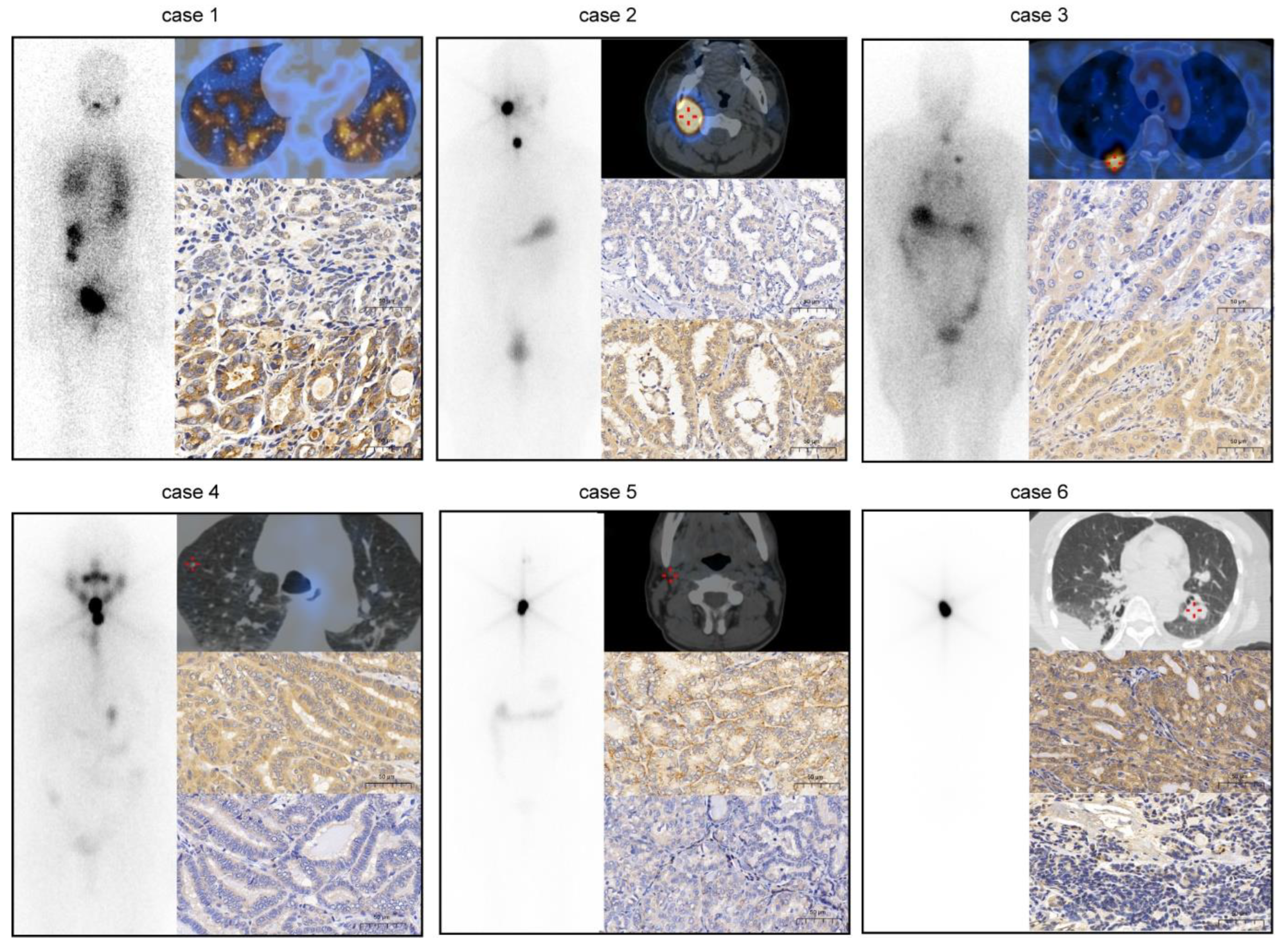 Cancers 14 01268 g002