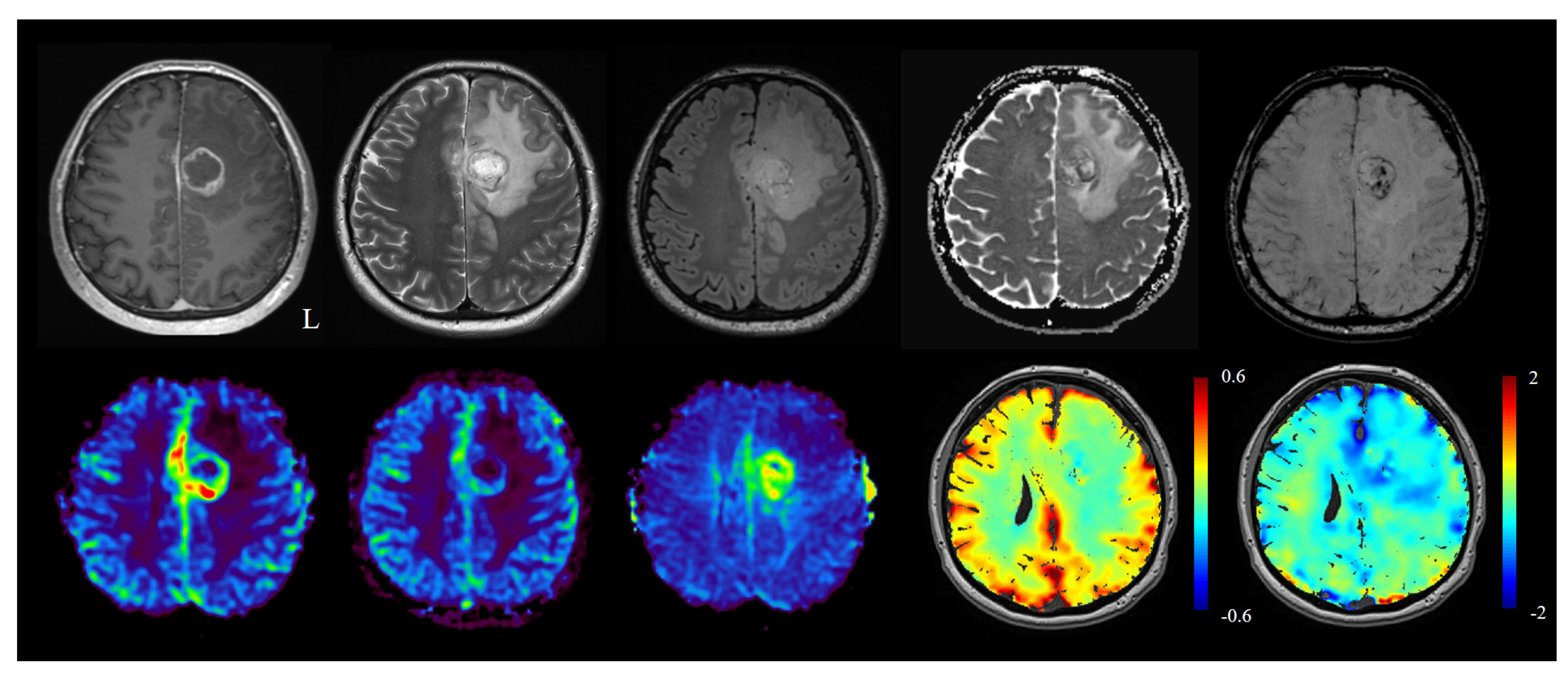 Cancers 14 01342 g002