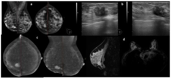 Calibrated Digital Mammography Scale