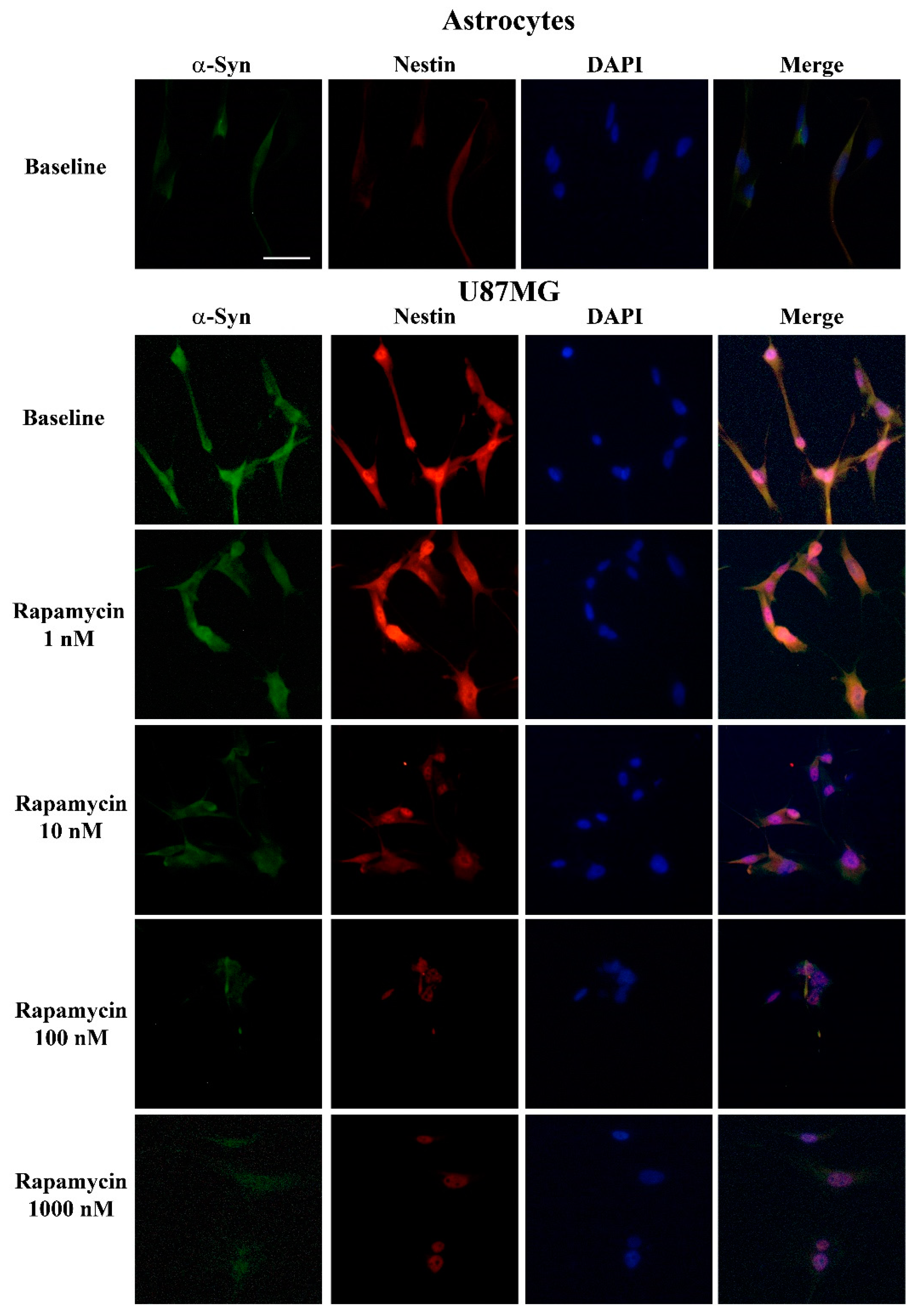 Cancers 14 01417 g007 Cancers 14 01417 g007