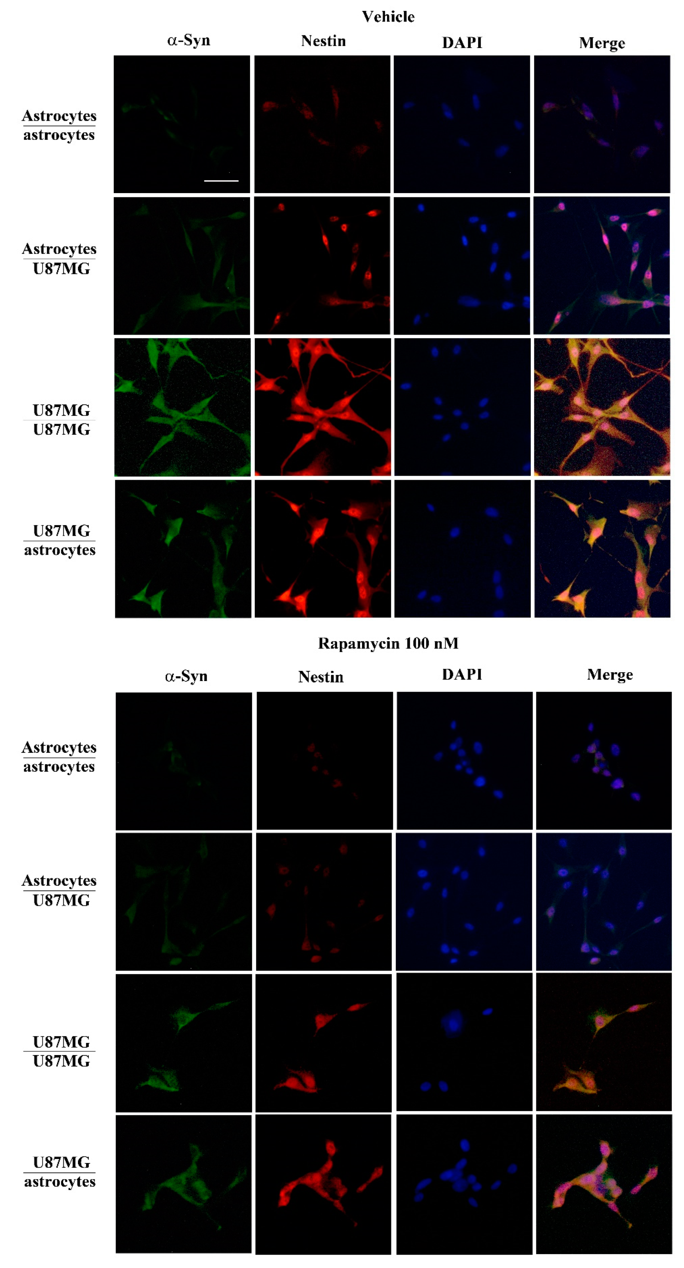 Cancers 14 01417 g009 Cancers 14 01417 g009