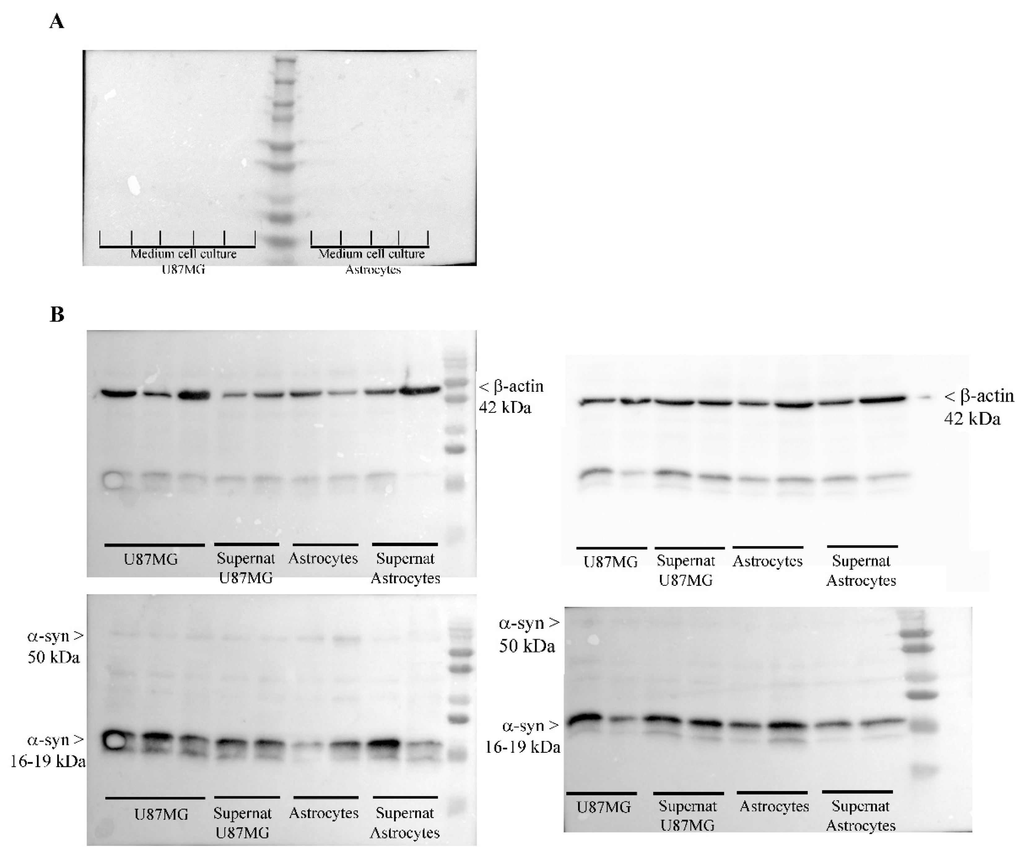Cancers 14 01417 g019 Cancers 14 01417 g019