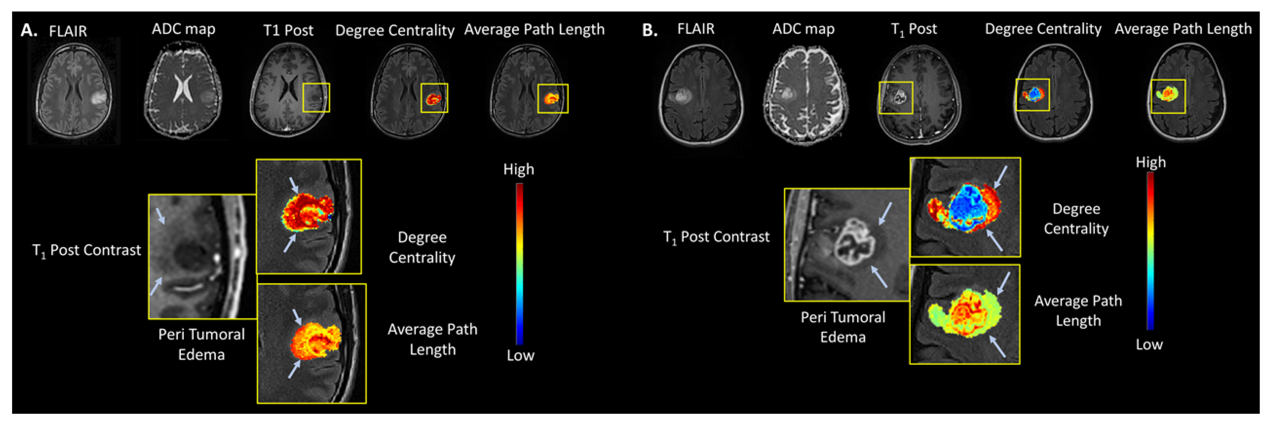 Cancers 14 01481 g004