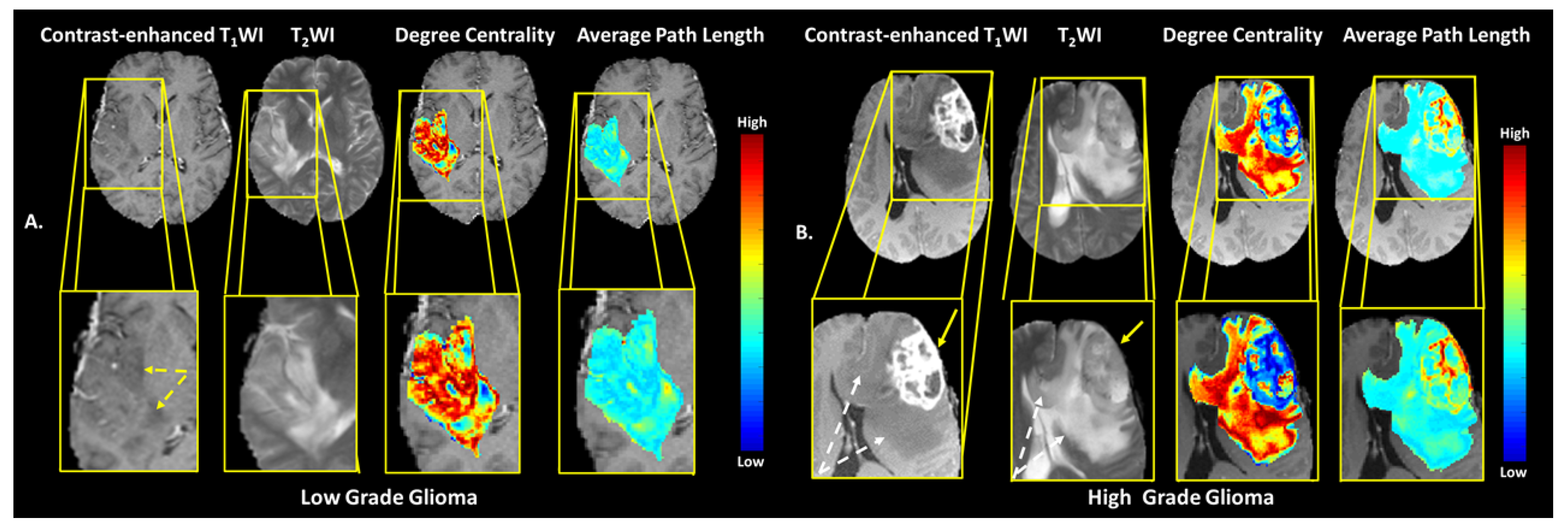 Cancers 14 01481 g007