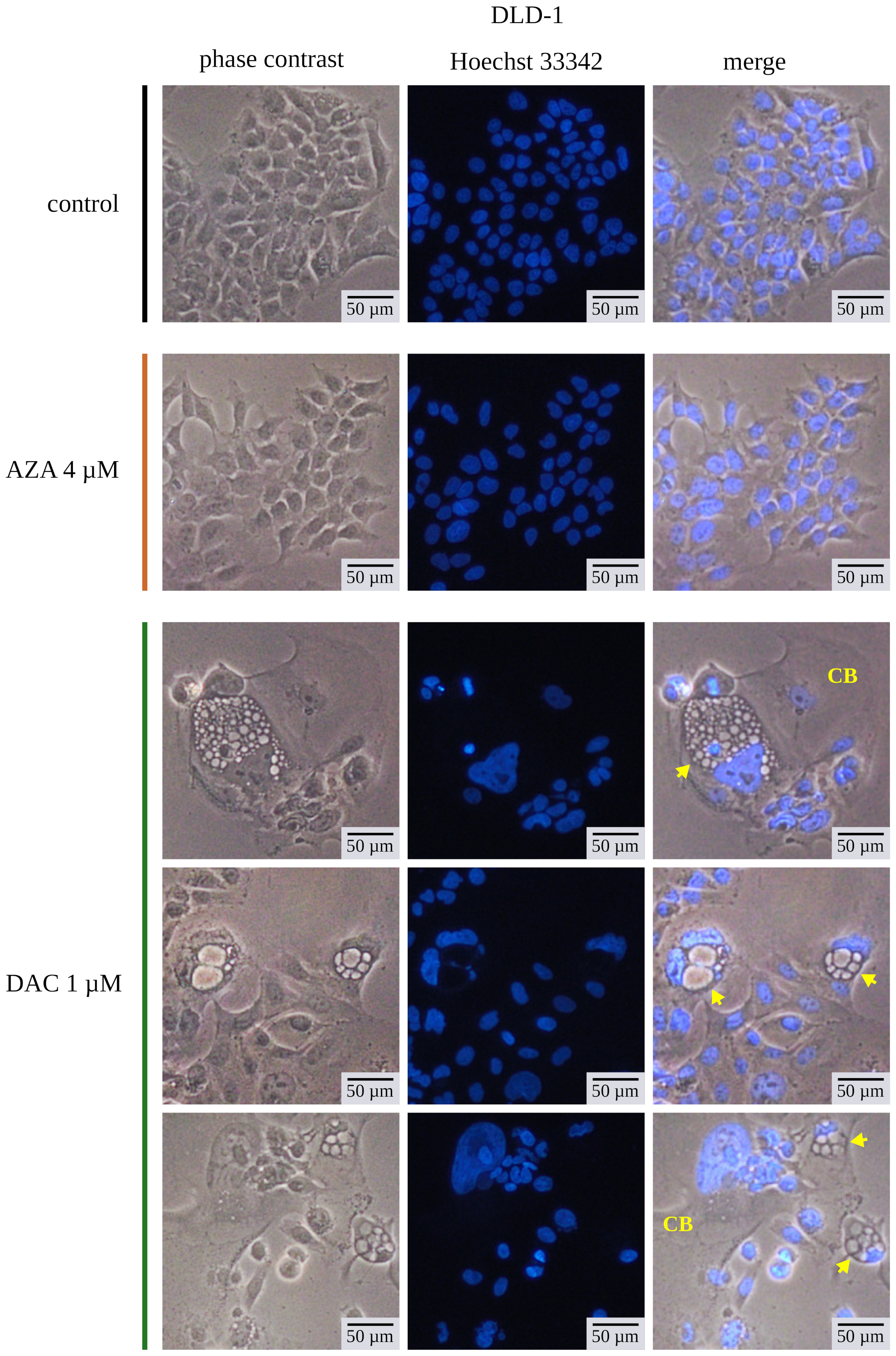 Cancers 14 01530 g008 Cancers 14 01530 g008