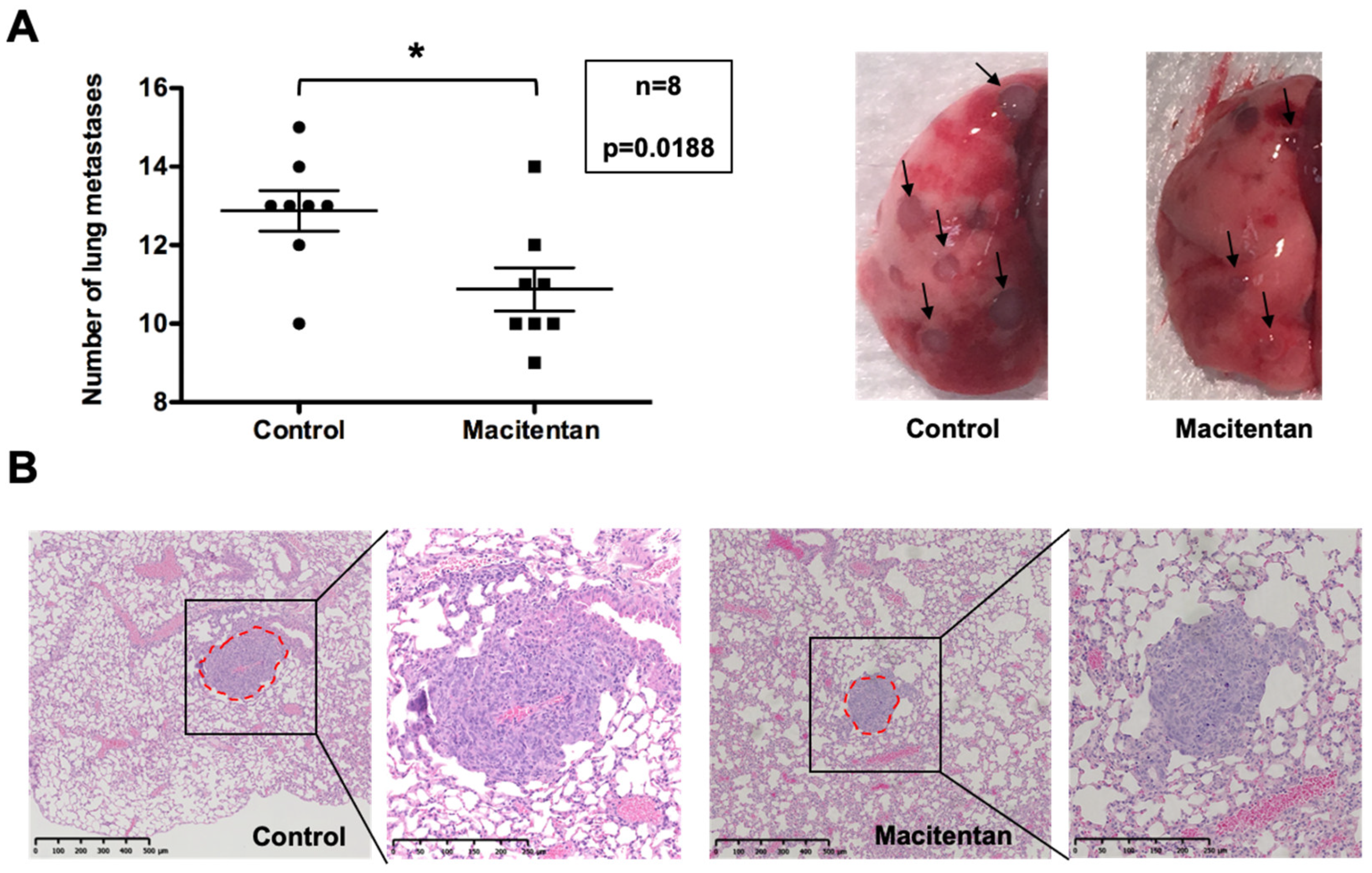 Cancers 14 01765 g006 Cancers 14 01765 g006