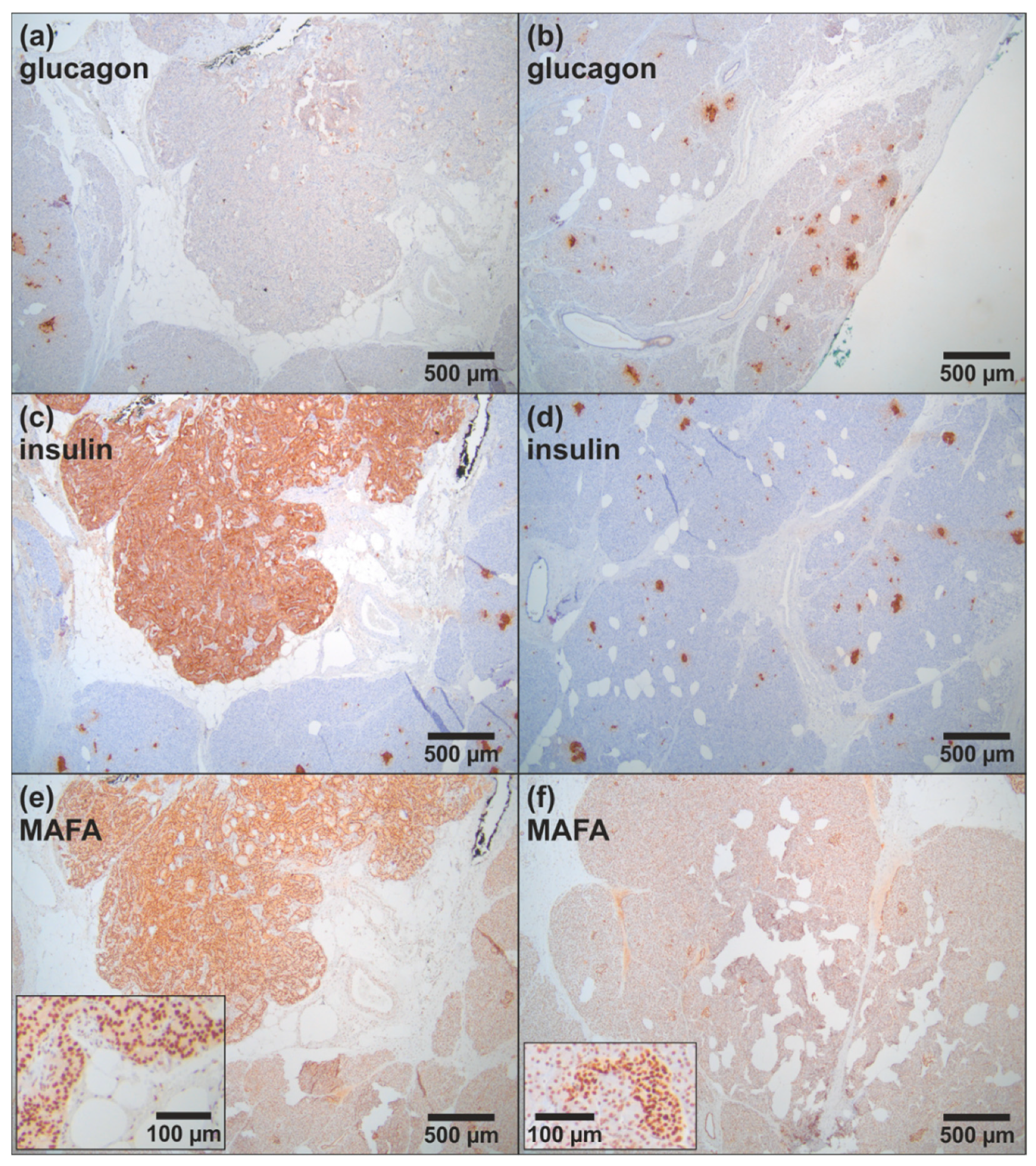 Cancers 14 01798 g003