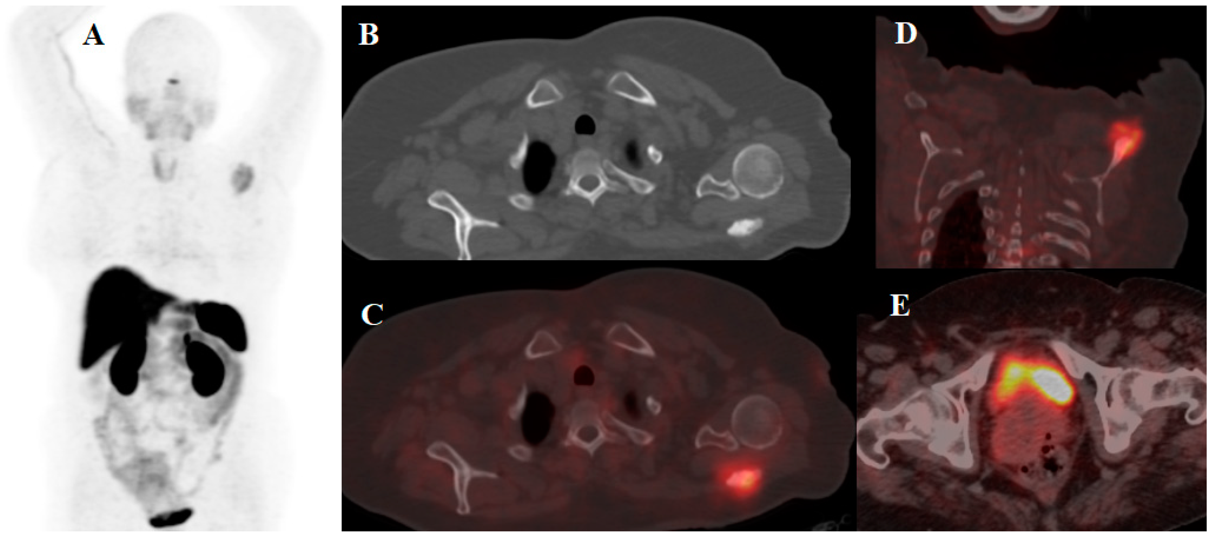 Cancers 14 01914 g003