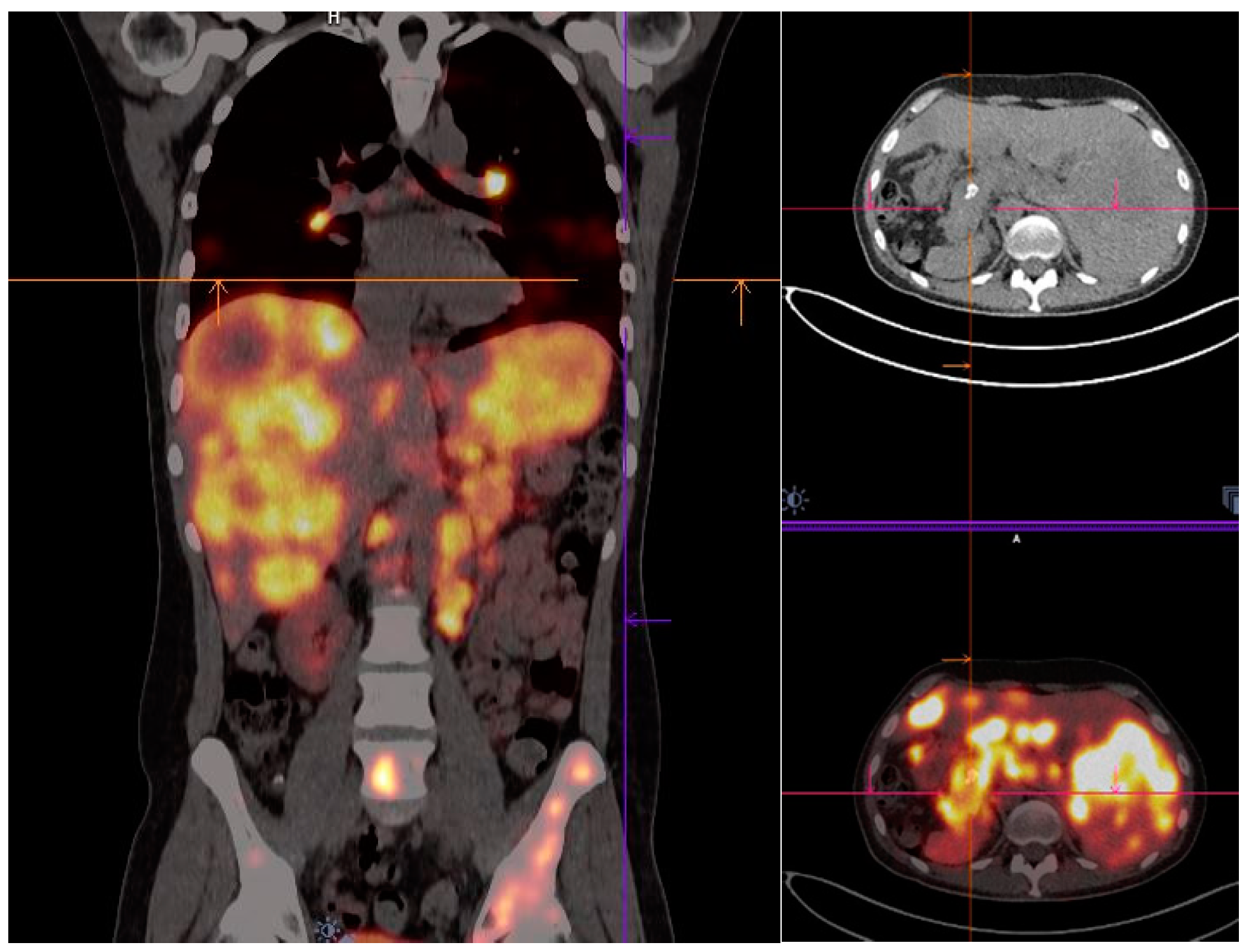 Cancers 14 01914 g004