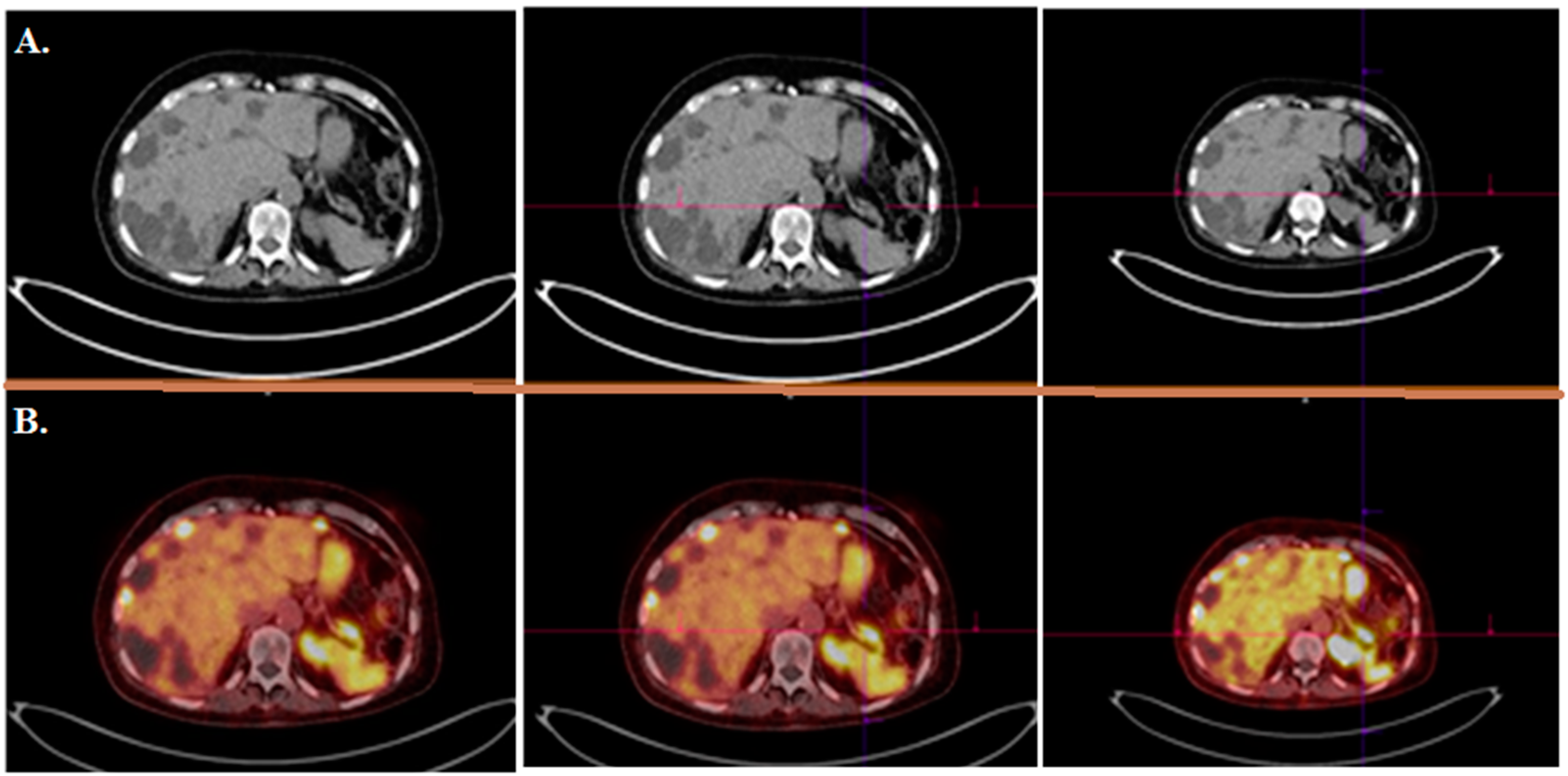 Cancers 14 01914 g006