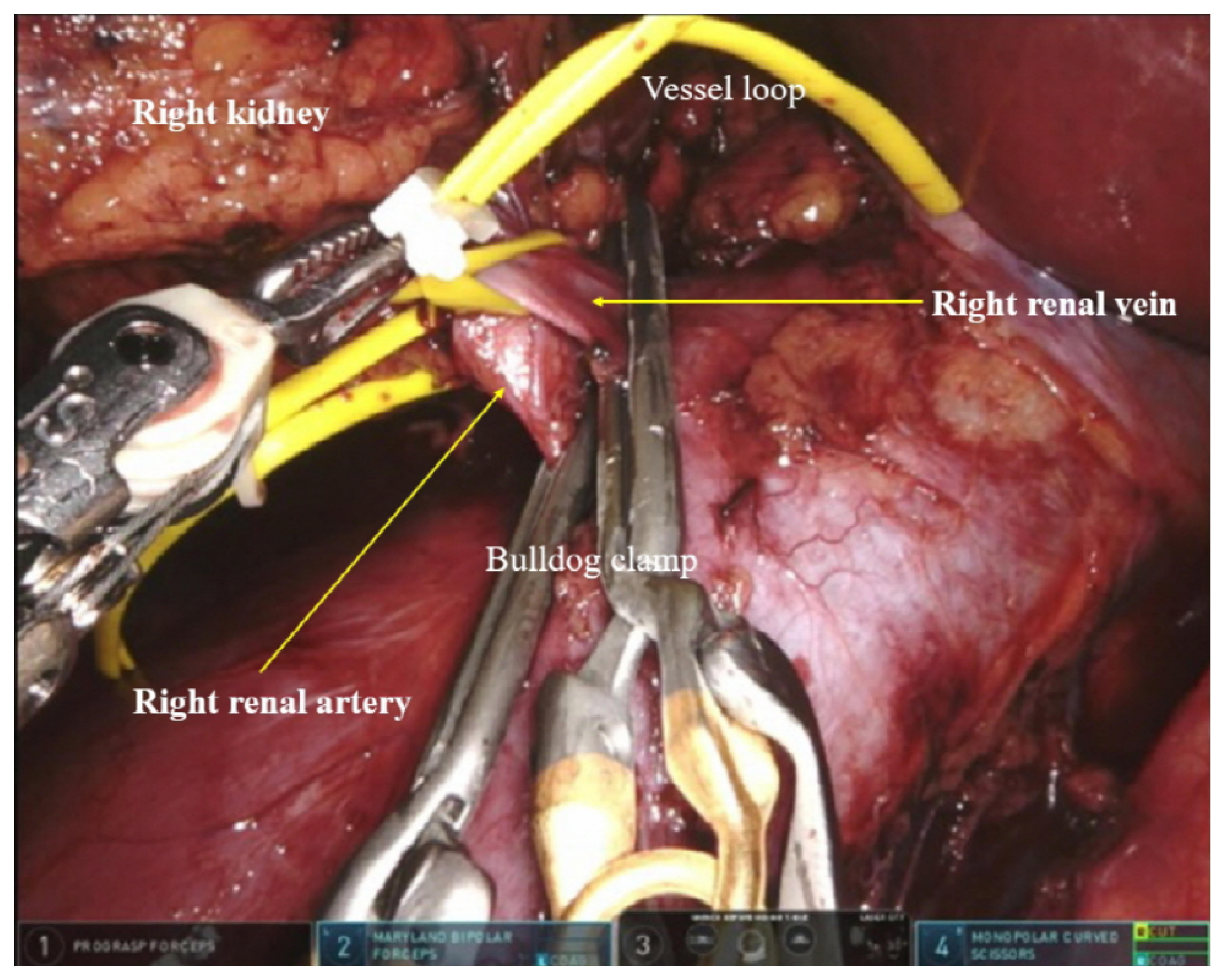 Cancers 14 01985 g002