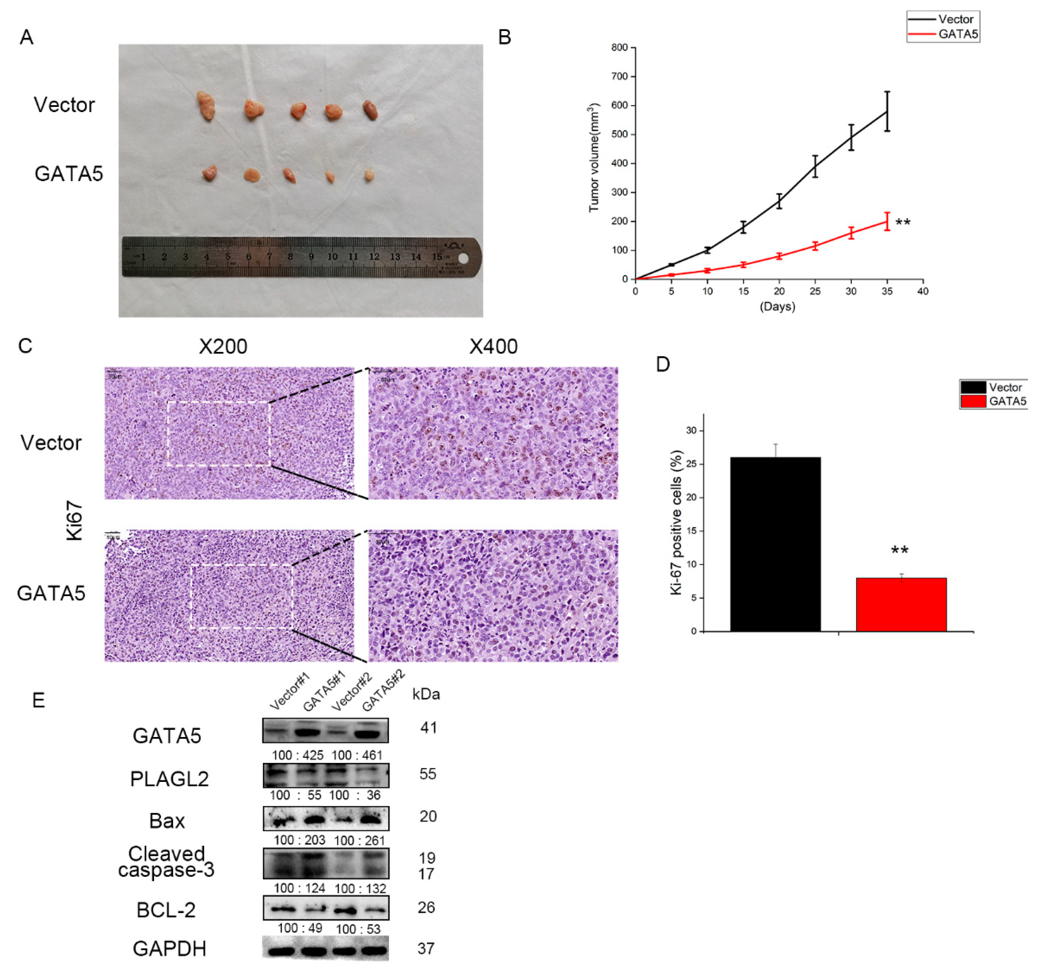 Cancers 14 02074 g005