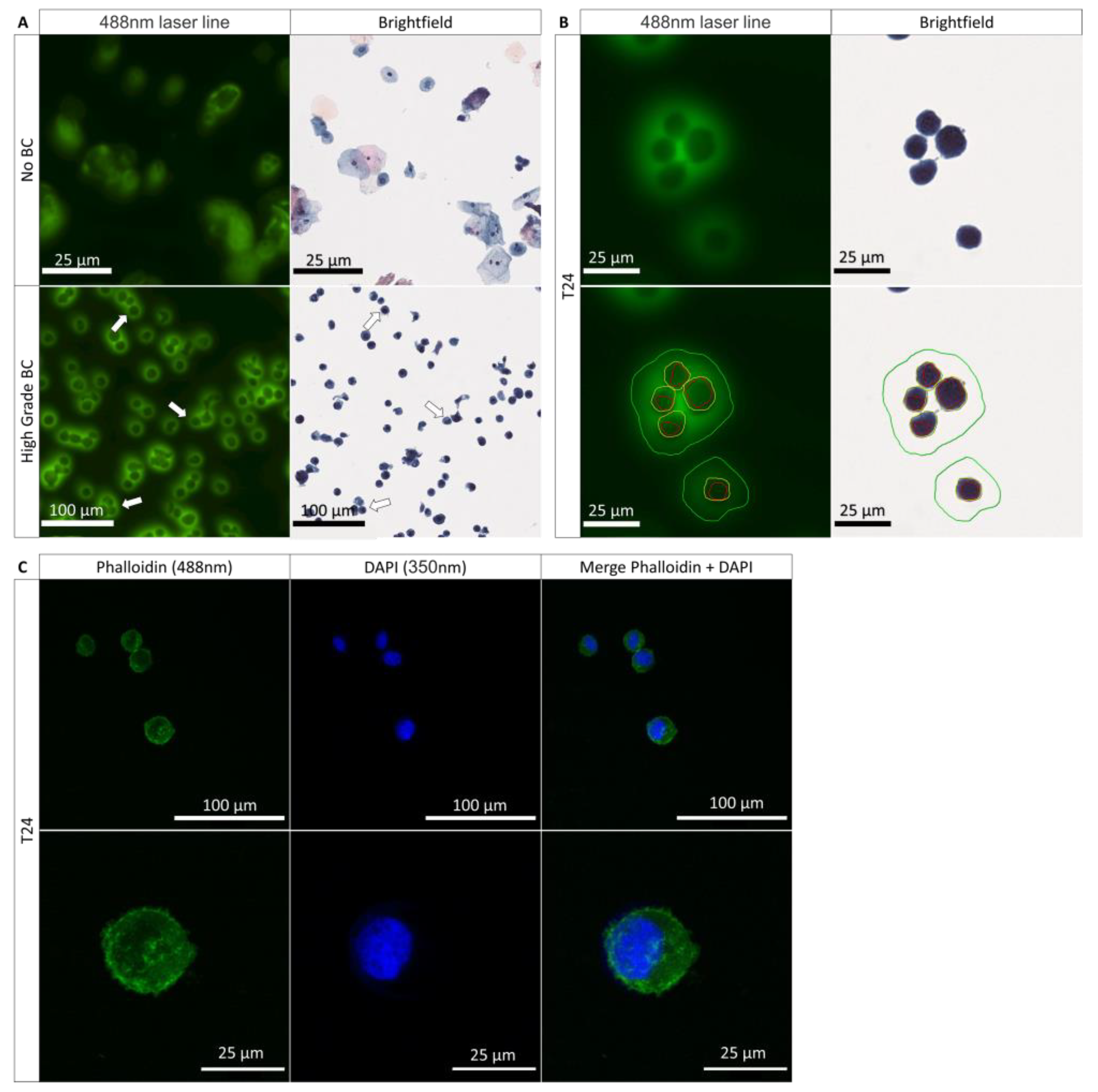 Cancers 14 02171 g001 Cancers 14 02171 g001