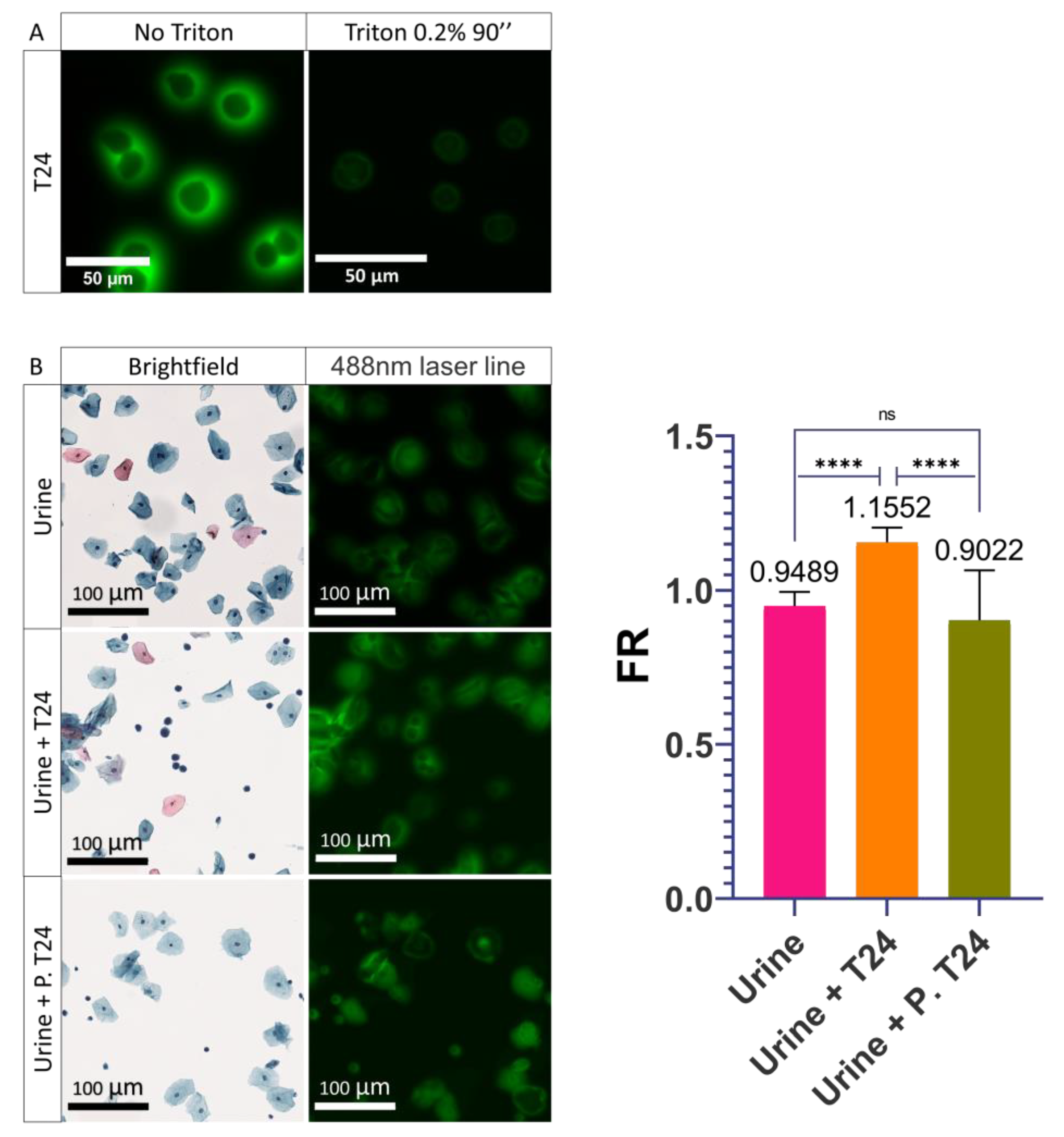 Cancers 14 02171 g004 Cancers 14 02171 g004