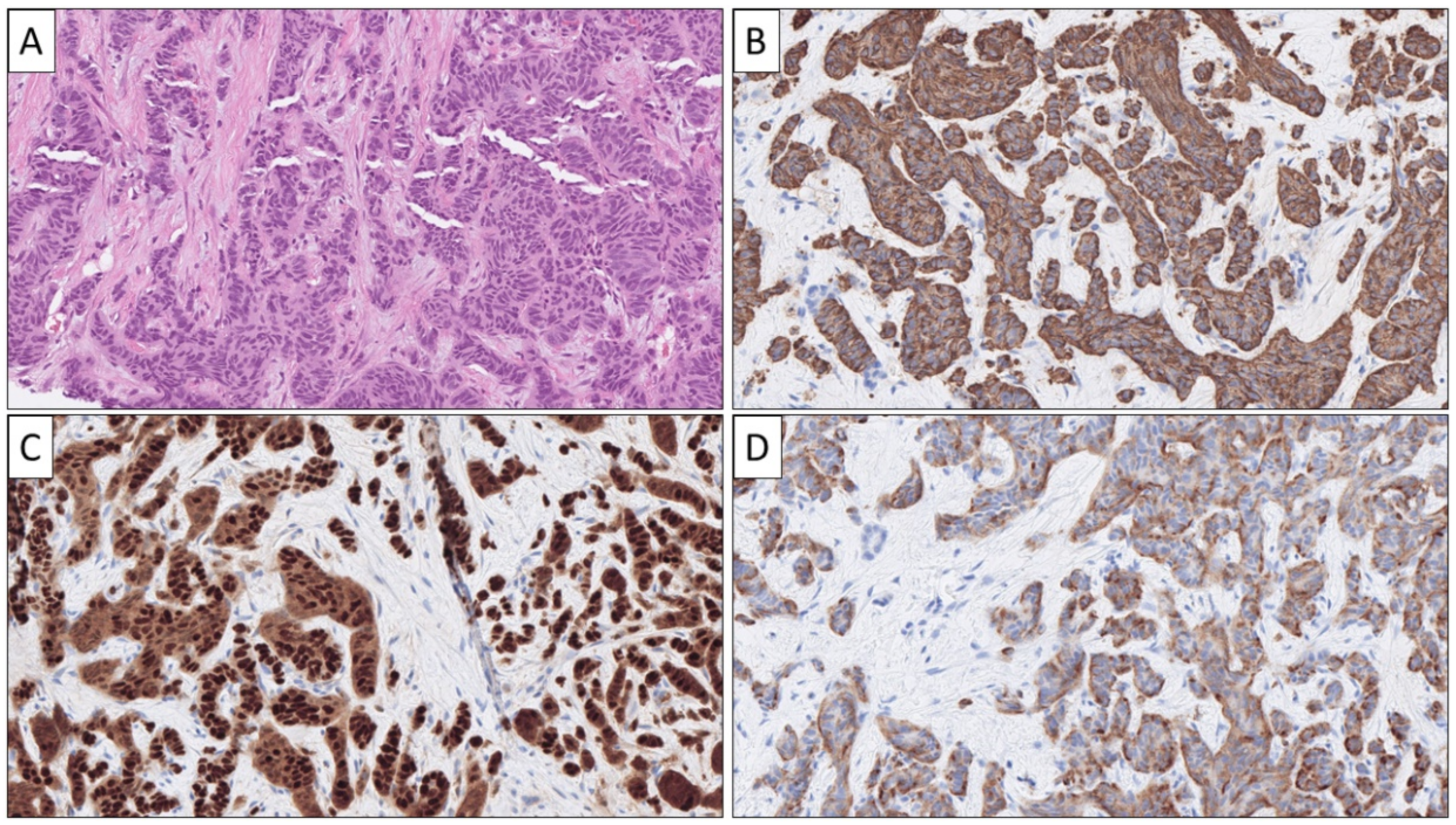 Cancers 14 02210 g001