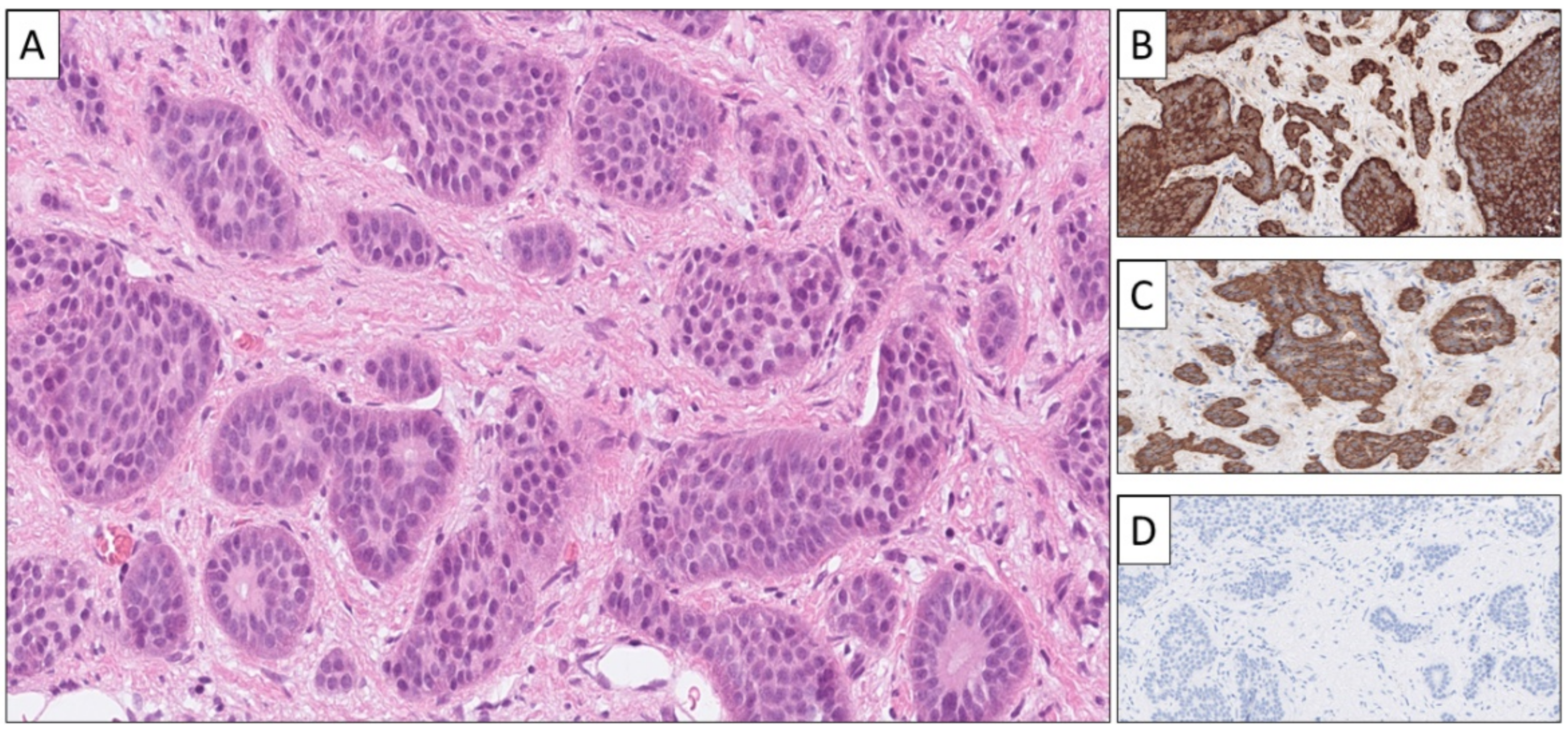 Cancers 14 02210 g002