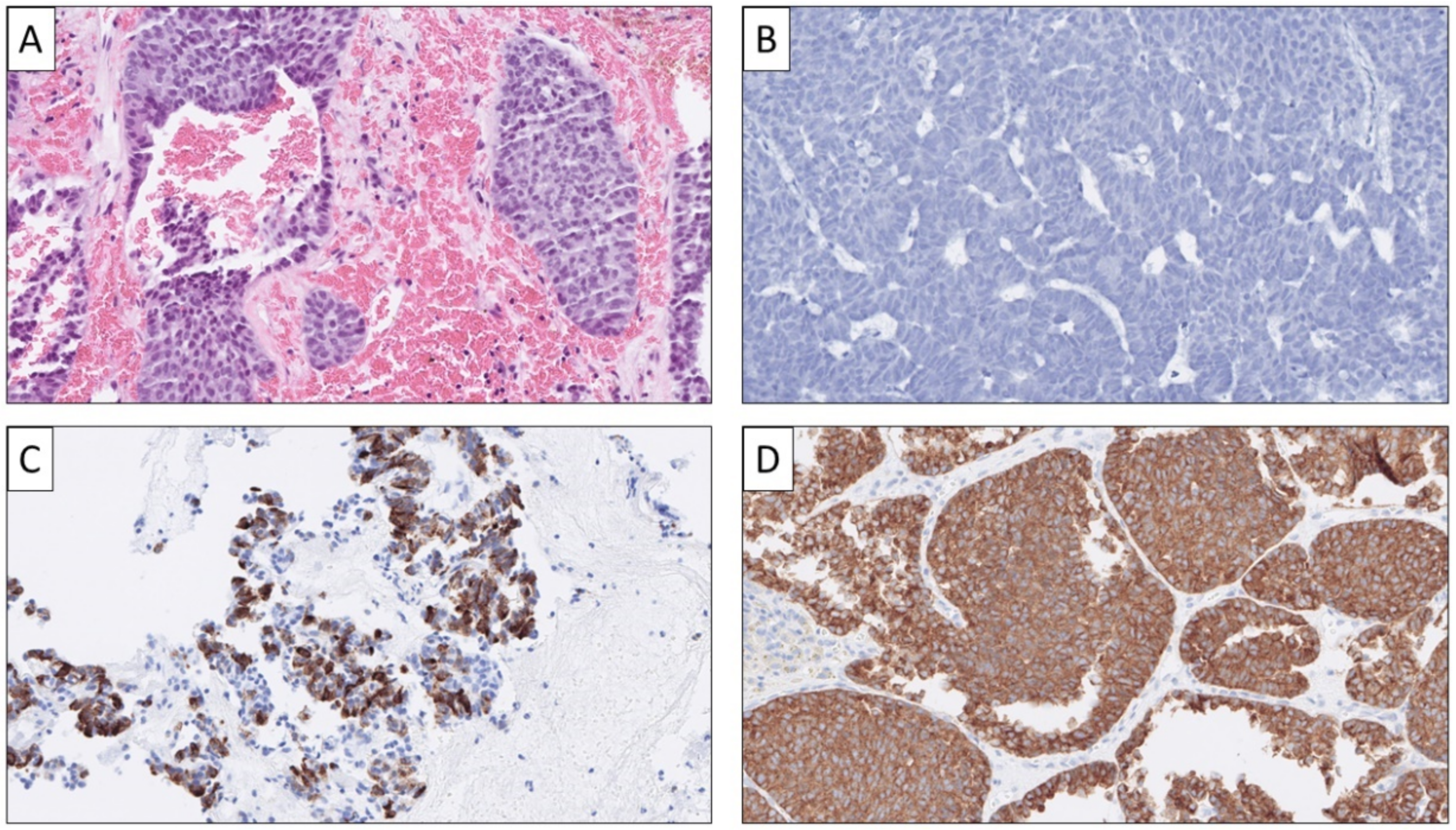 Cancers 14 02210 g004