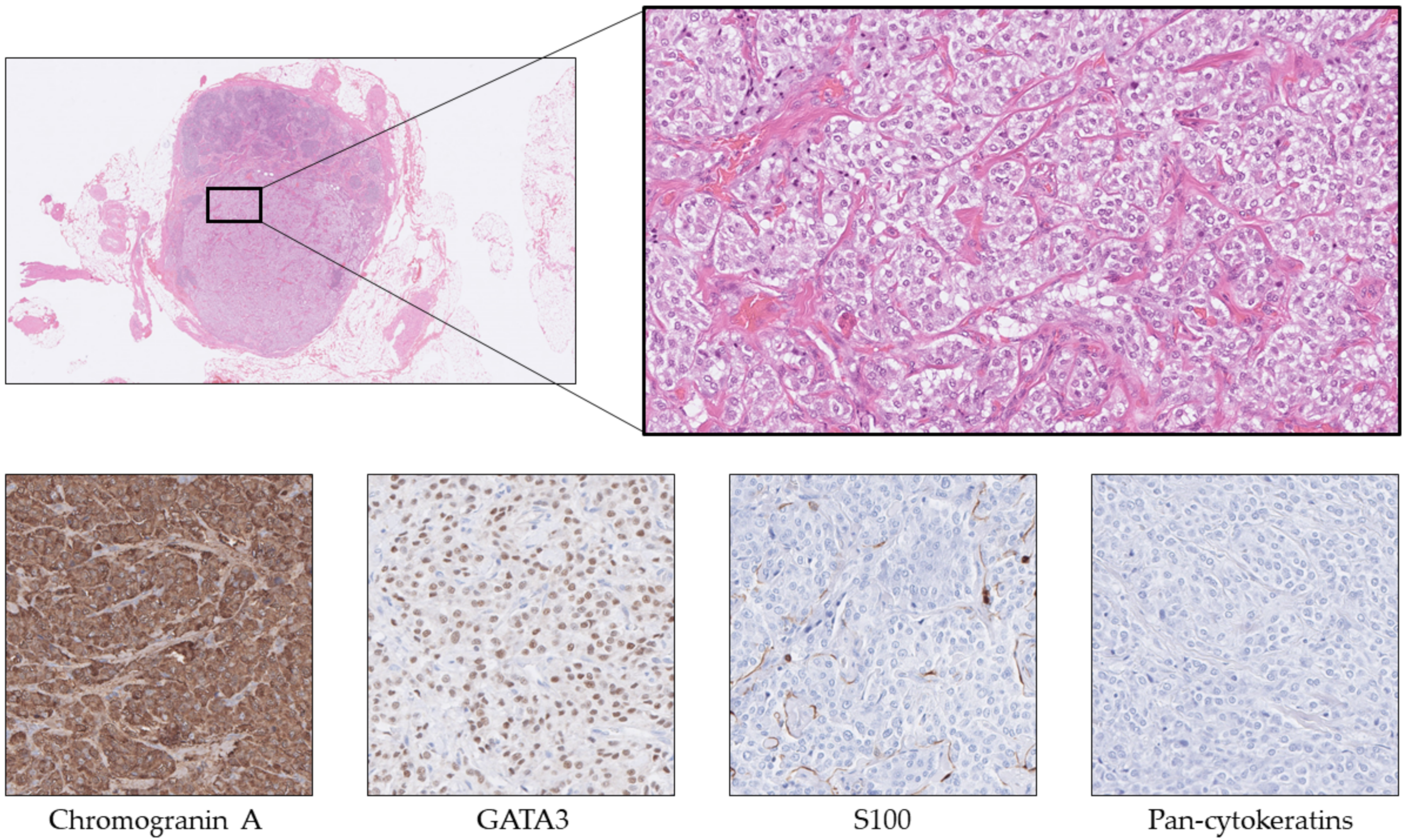 Cancers 14 02210 g005