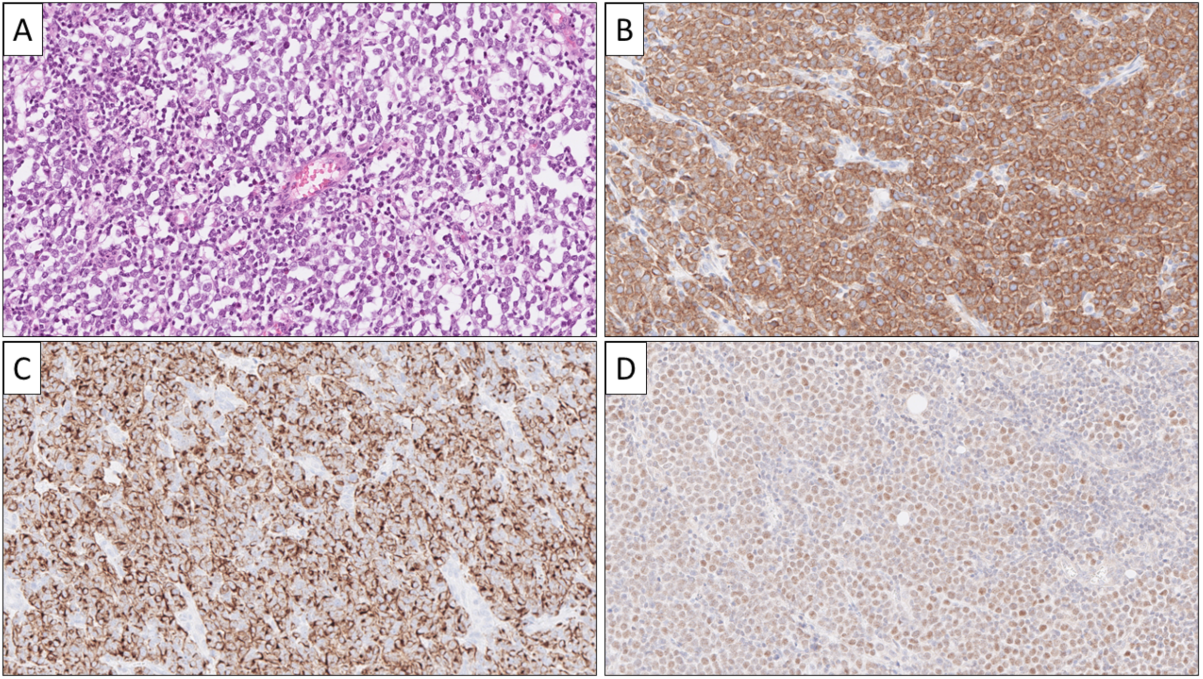 Cancers 14 02210 g006